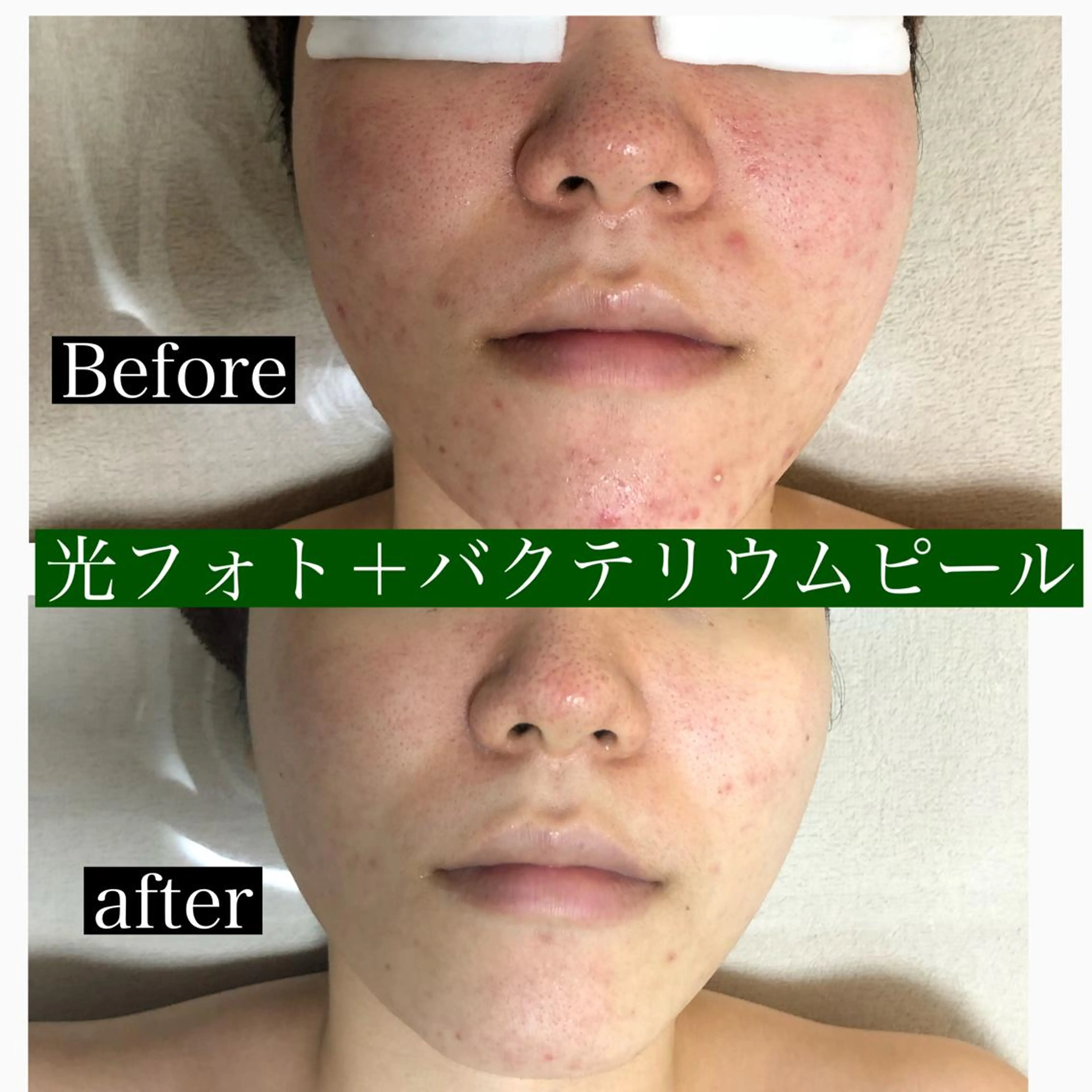 美肌脱毛と癒しのﾌﾟﾗｲﾍﾞｰﾄｻﾛﾝ。gratia~ｸﾞﾚｲﾃｨｱ~所属・gratia ~ｸﾞﾚｲﾃｨｱ~のエステ・リラクイメージ