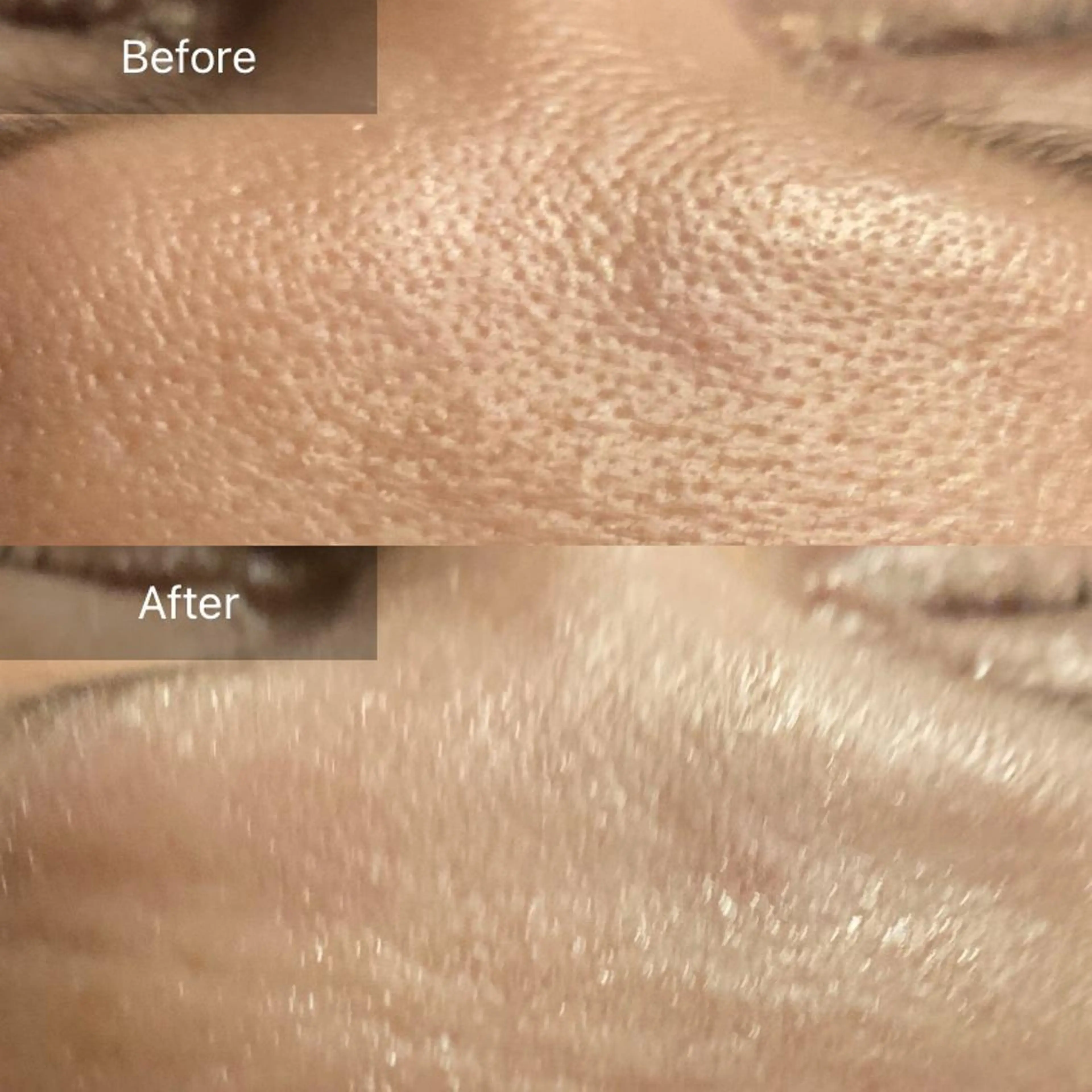 Mandarin Orange所属・毛穴から始める肌メン テマンダリンオレンジのエステ・リラクイメージ