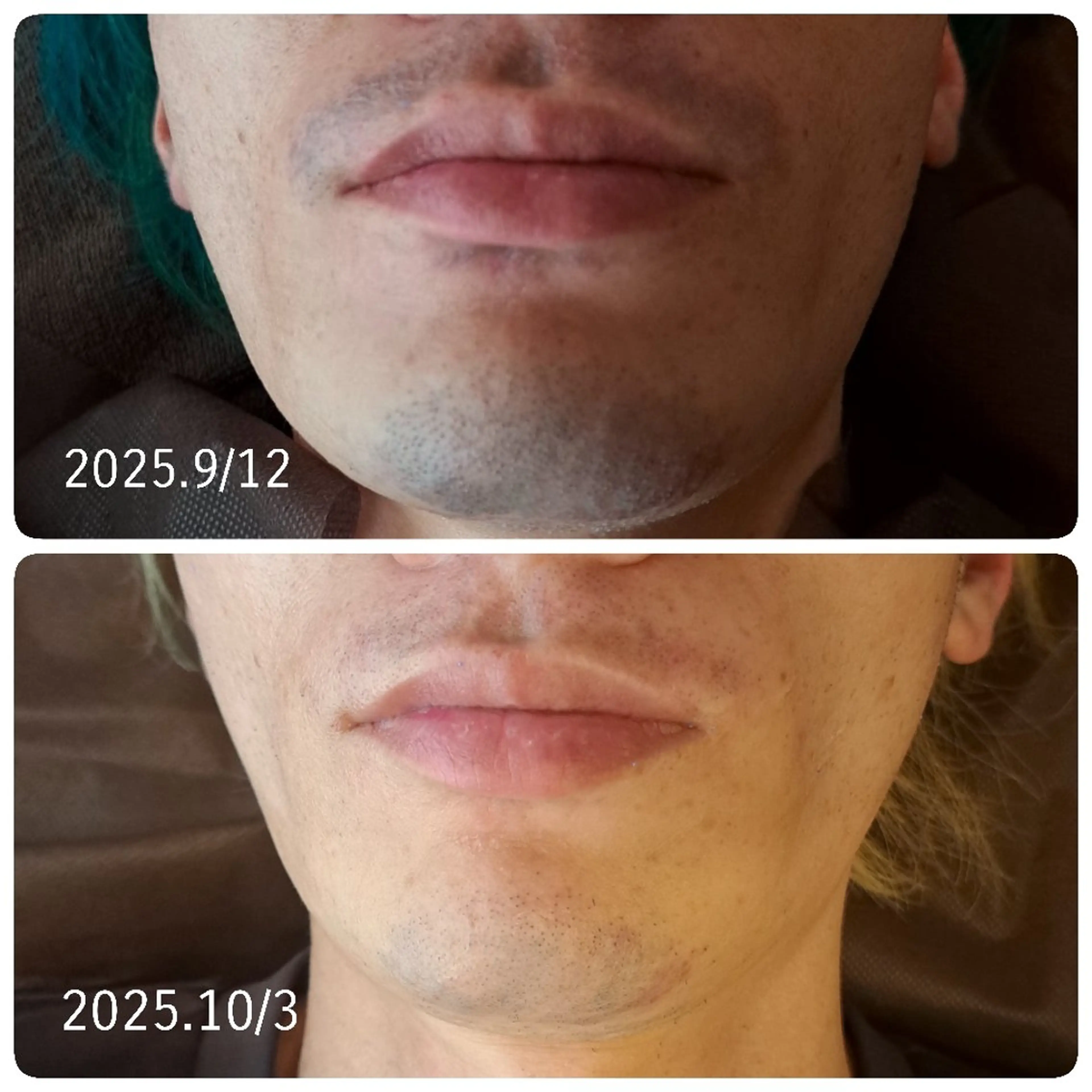 メンズ 都度払いエステ Un Reve メンズ&レディース 津幡店所属・石黒 奈美子のエステ・リラクイメージ