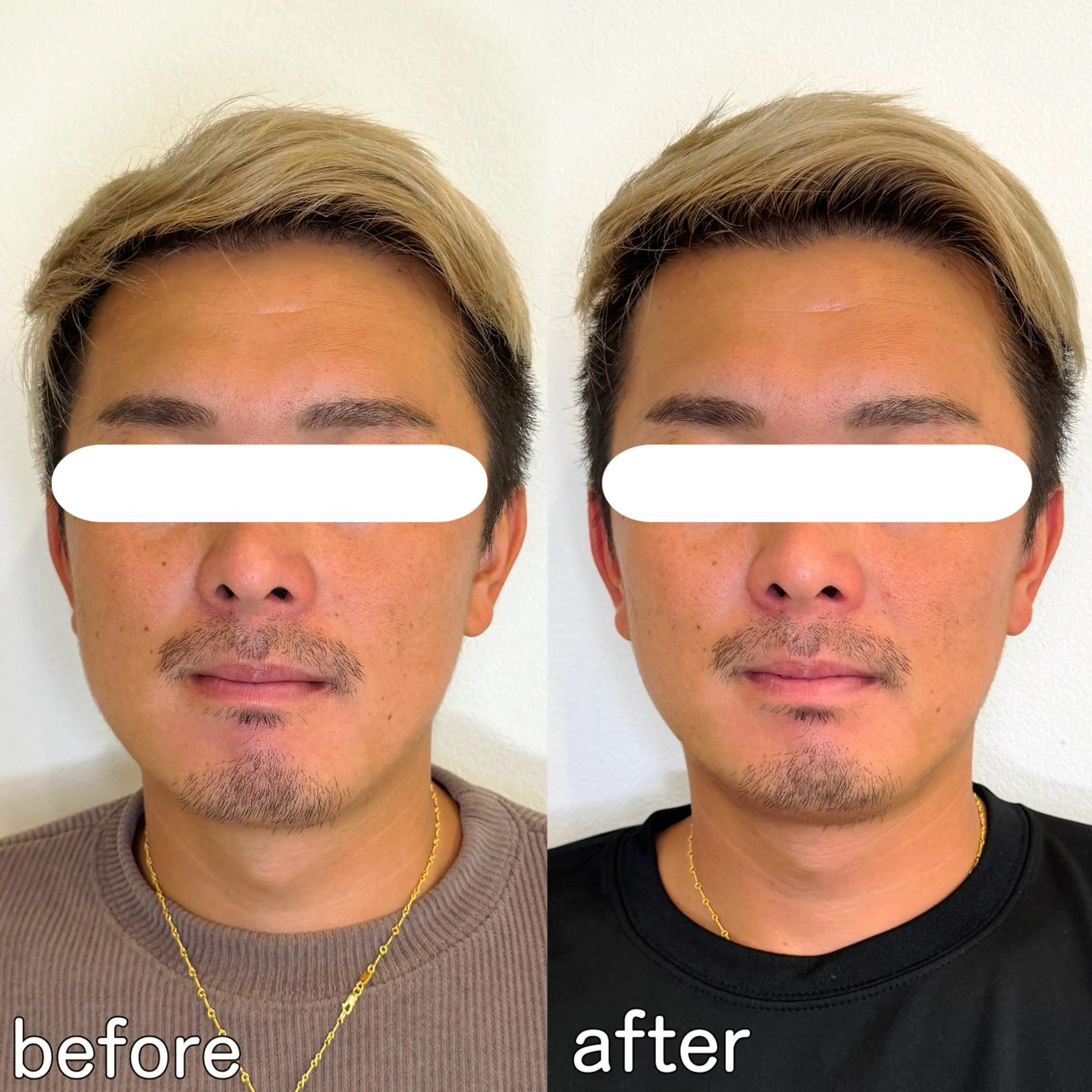 小顔矯正&美容整体 整え屋REDオーナーのエステ・リラクイメージ