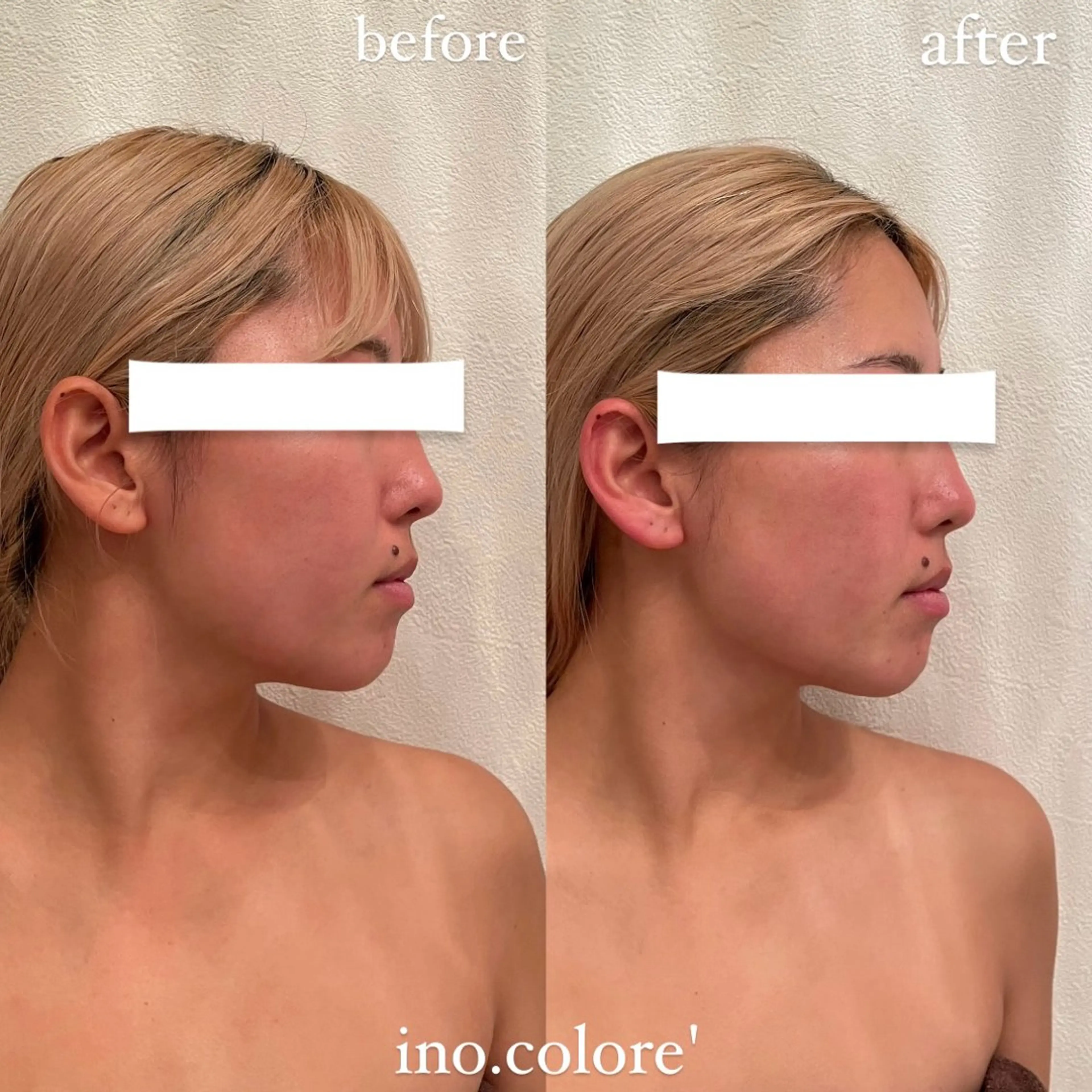 エステ リラク エステサロンino.colore'所属・小顔サロン ino.coloreのエステ・リラクイメージ