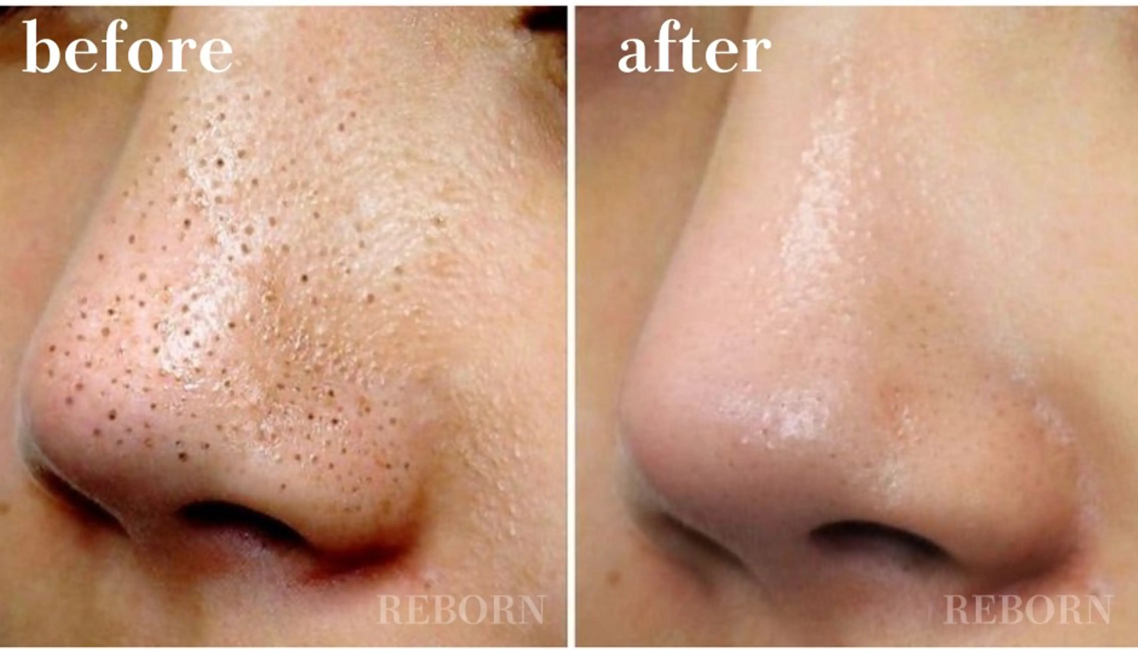 REBORN所属 藤木あおいのエステ・リラクイメージ