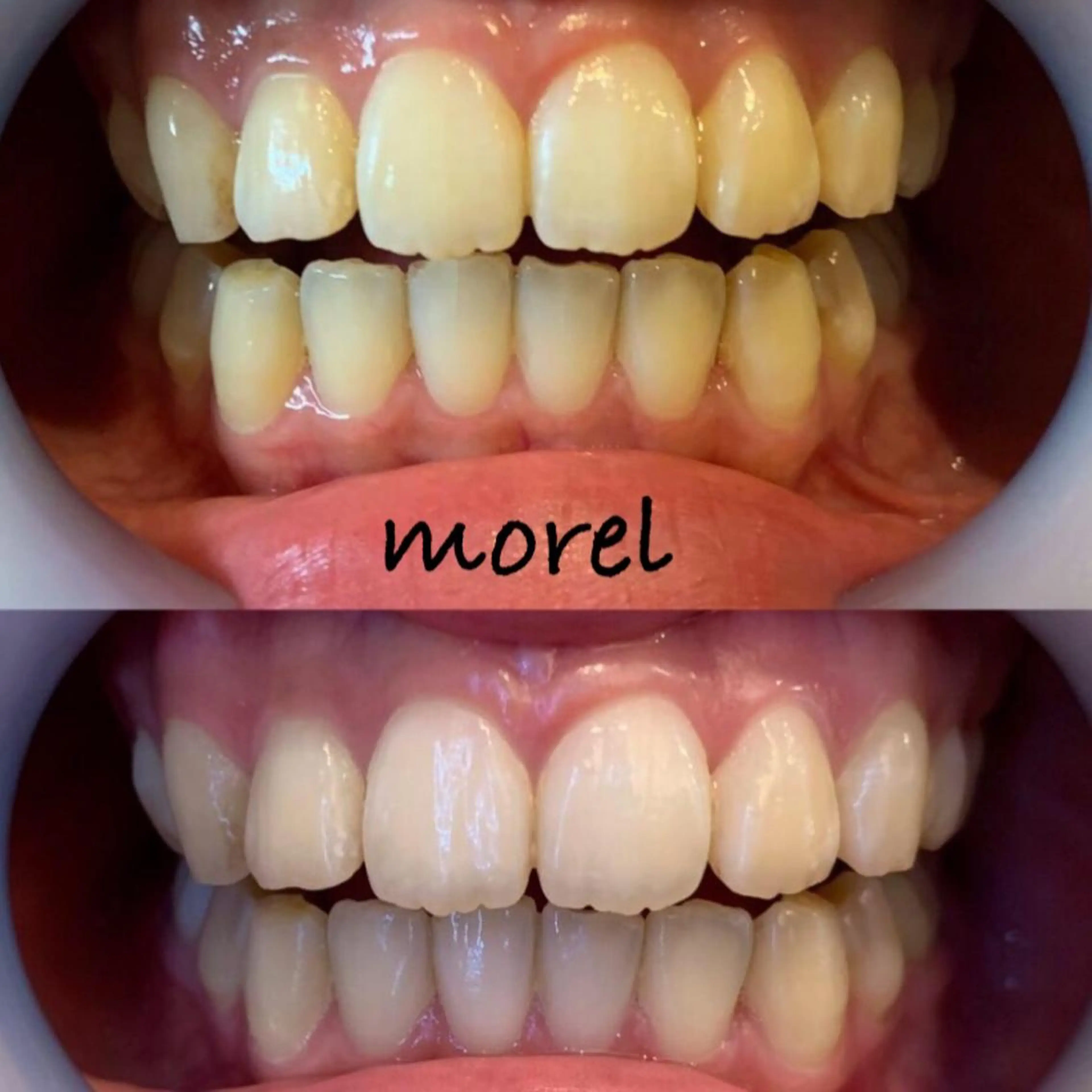 morel モレルのマツエク・マツパデザイン