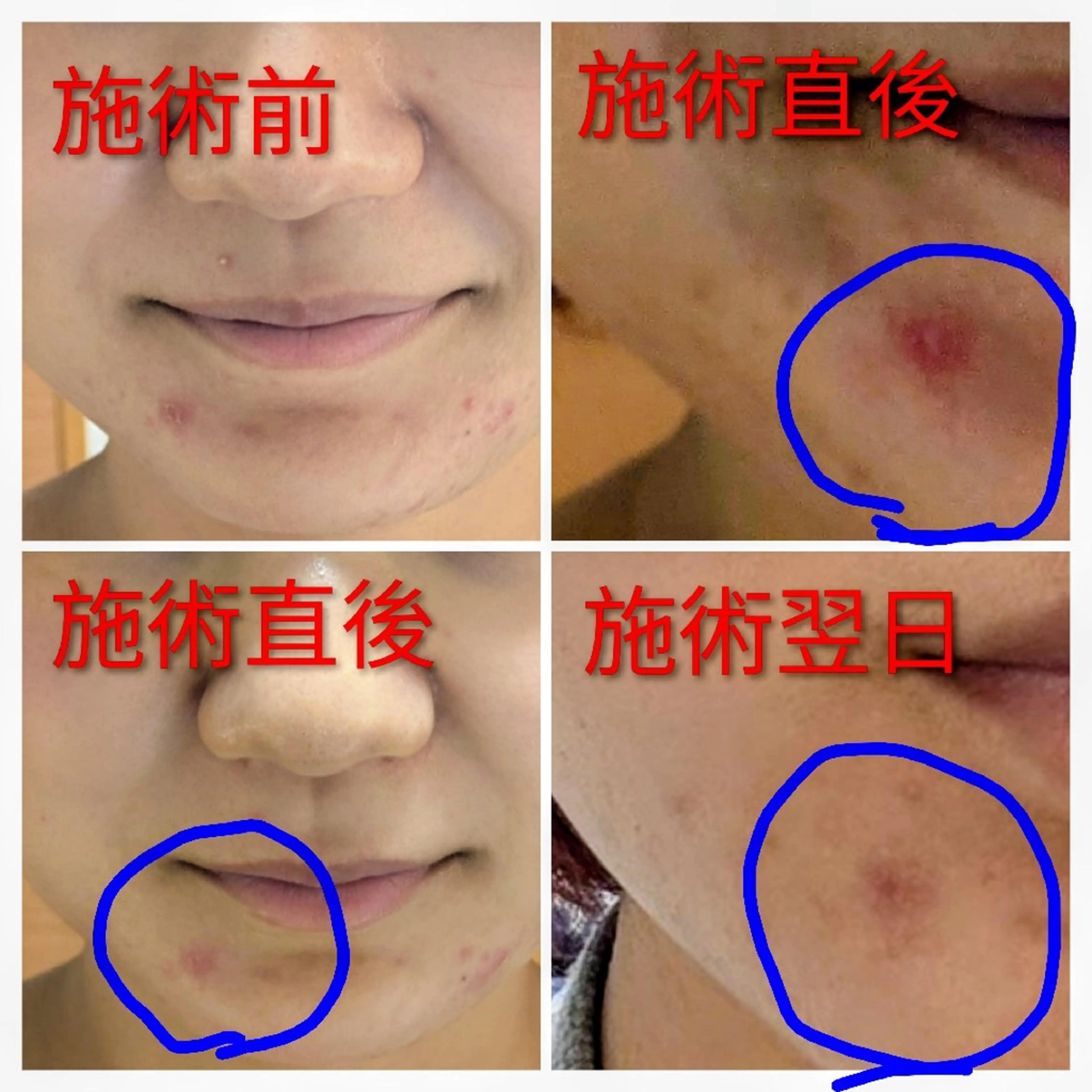 フェイシャルエステ アンソン・ドゥのエステ・リラクイメージ