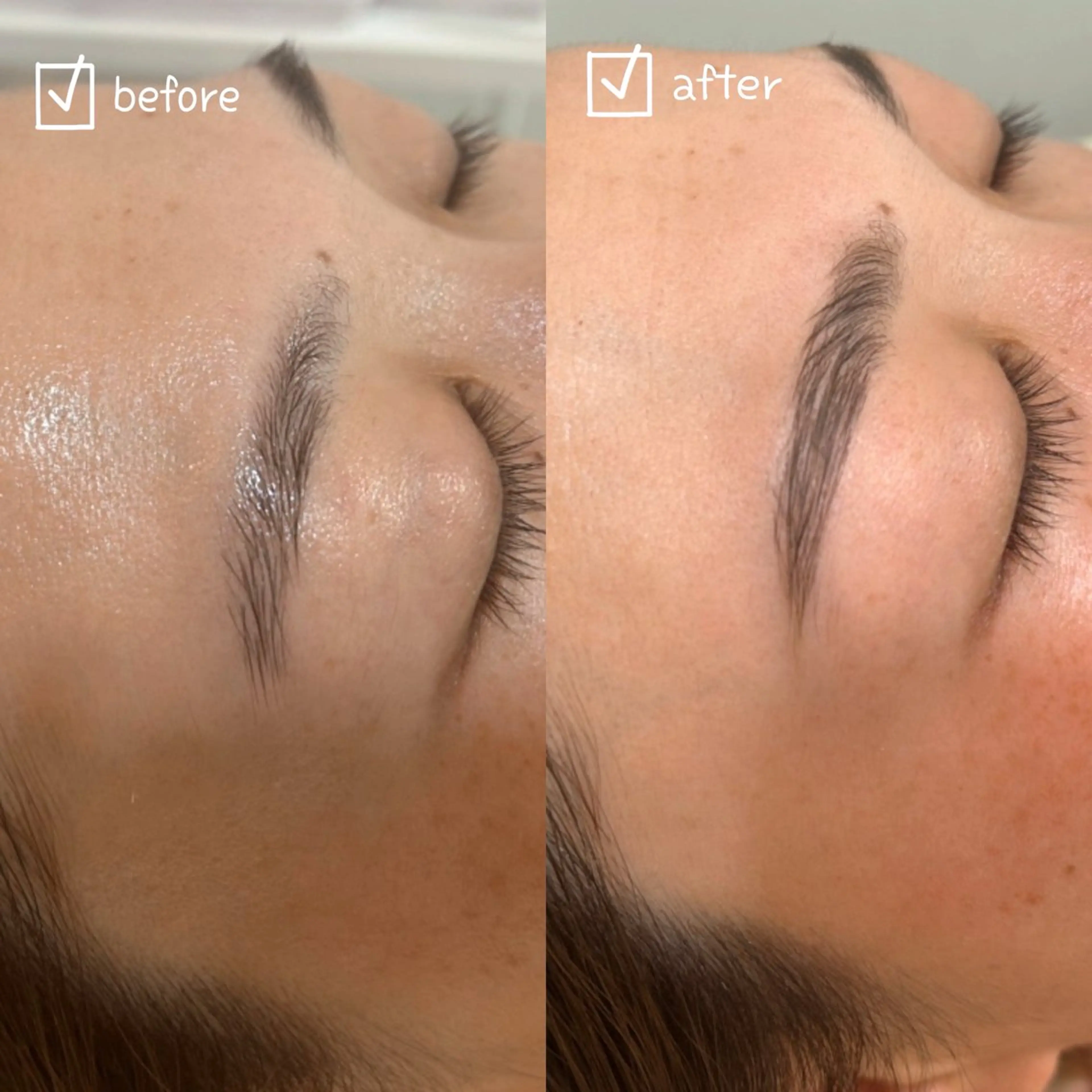 ハリウッドブロウリフト(美眉スタイリング)の写真