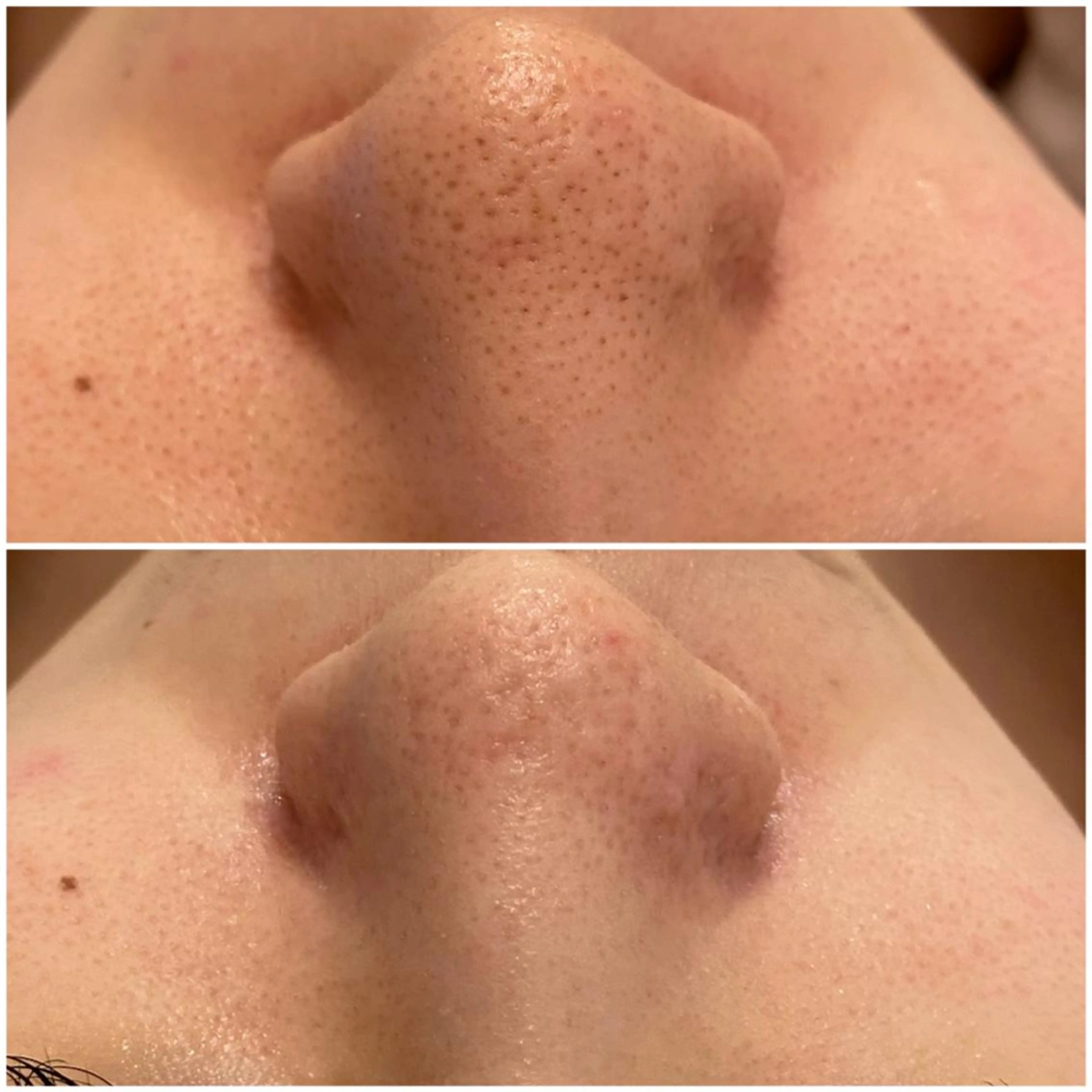 ✨美肌水光✨ アトリエリュバンのエステ・リラクイメージ