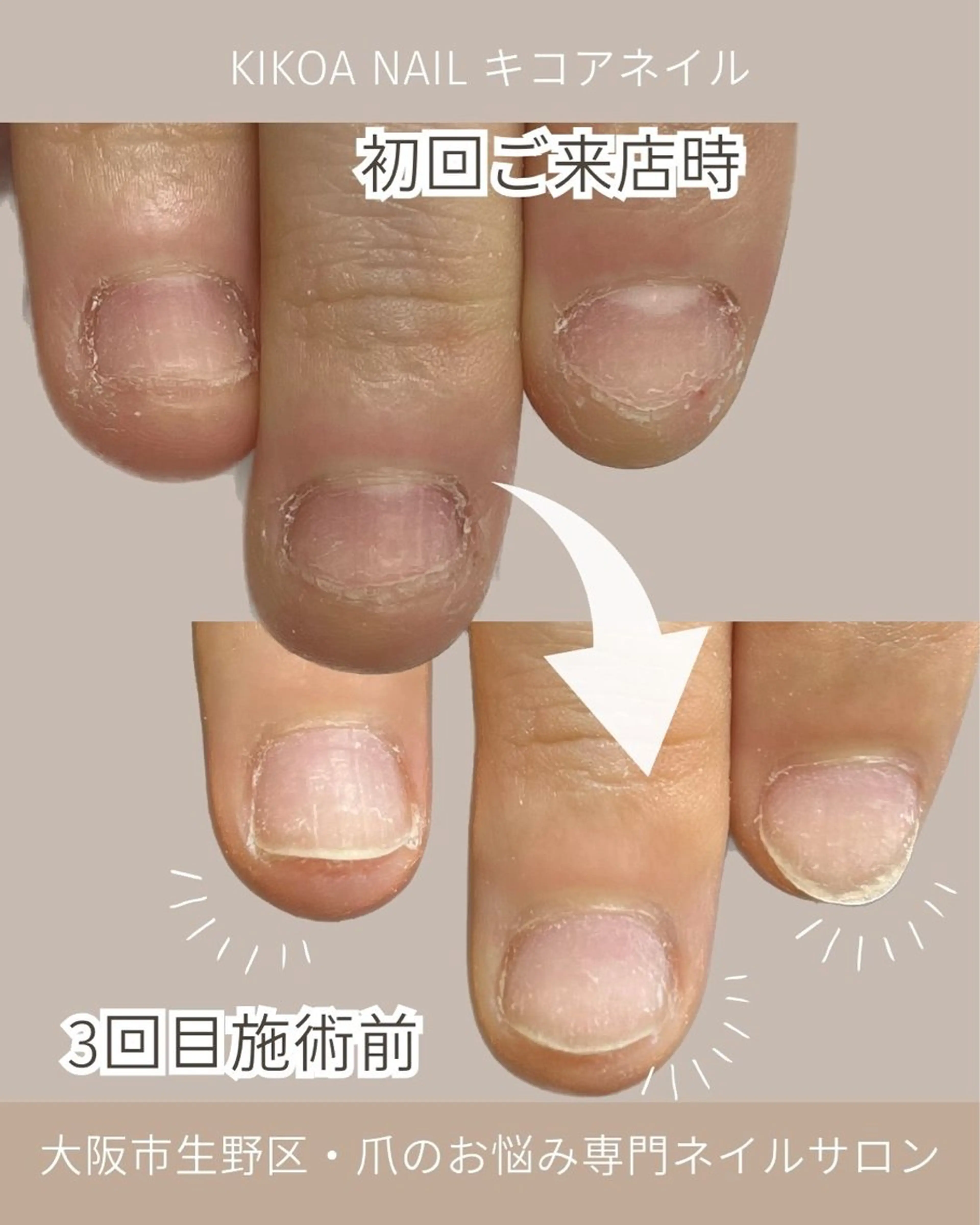 ネイル KIKOA NAIL キコアネイルのネイルデザイン