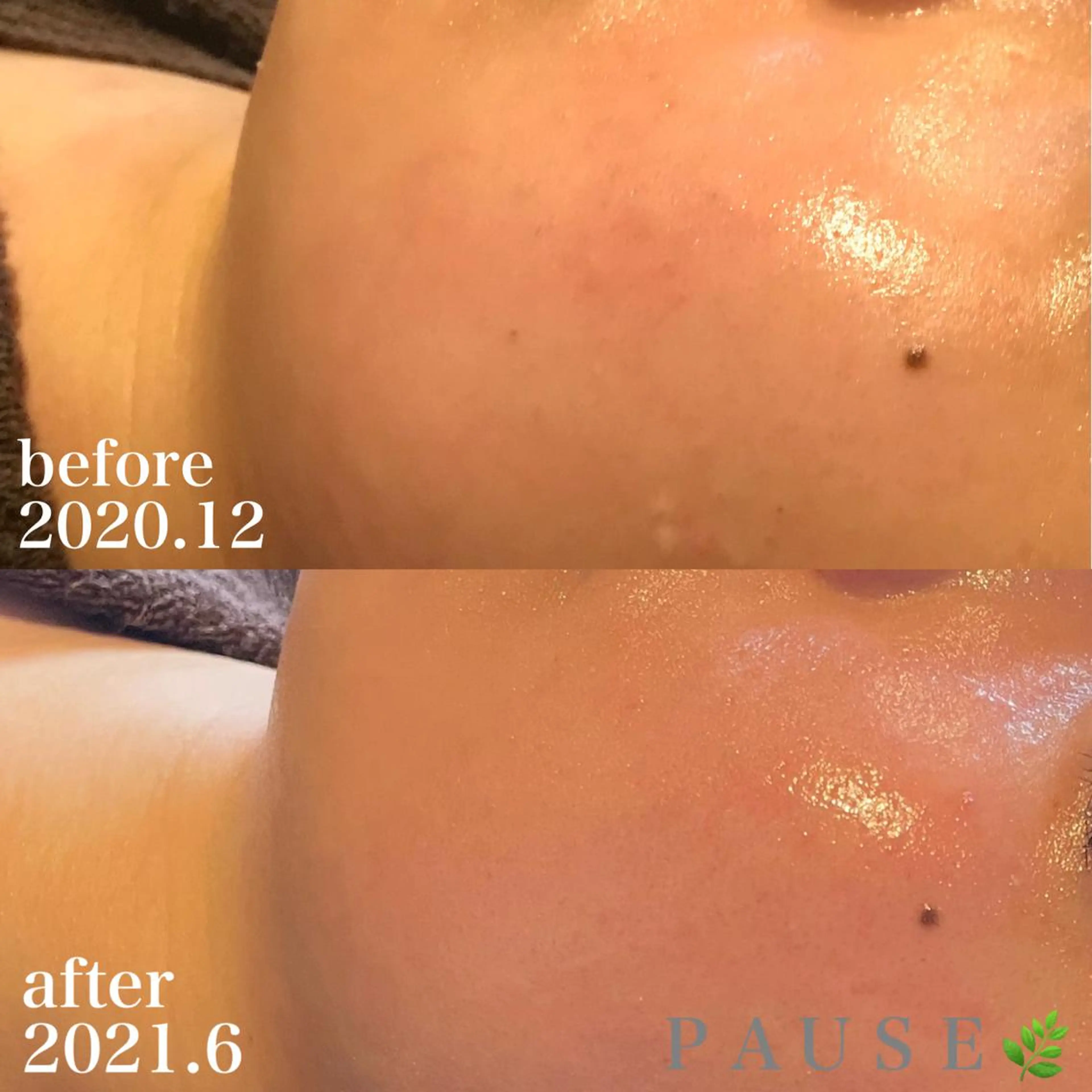 エステ 浜野 恵美のエステ・リラクイメージ