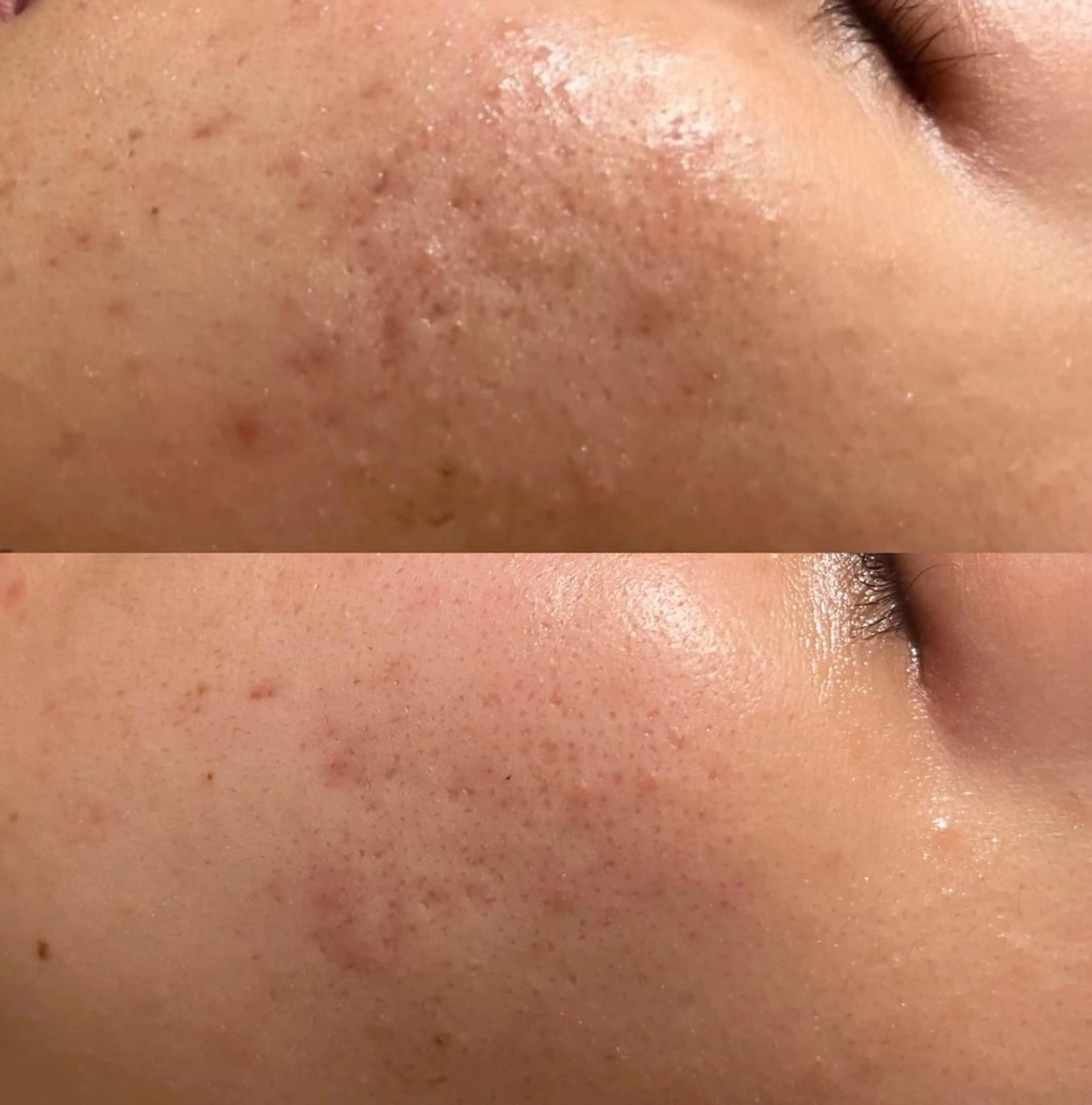 その他 for woman所属・森 美優のエステ・リラクイメージ