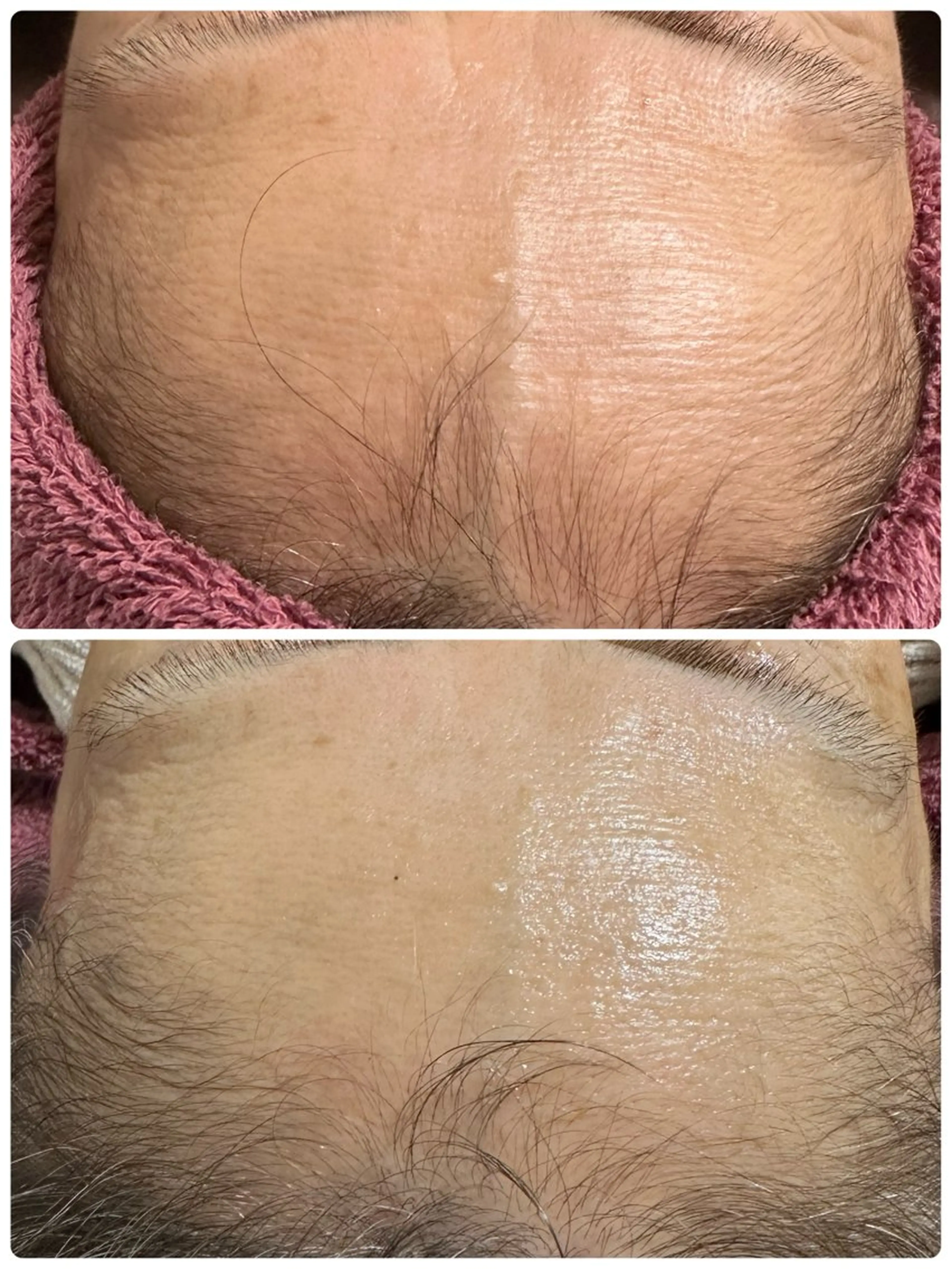 エステ 越猪 未来のネイルデザイン