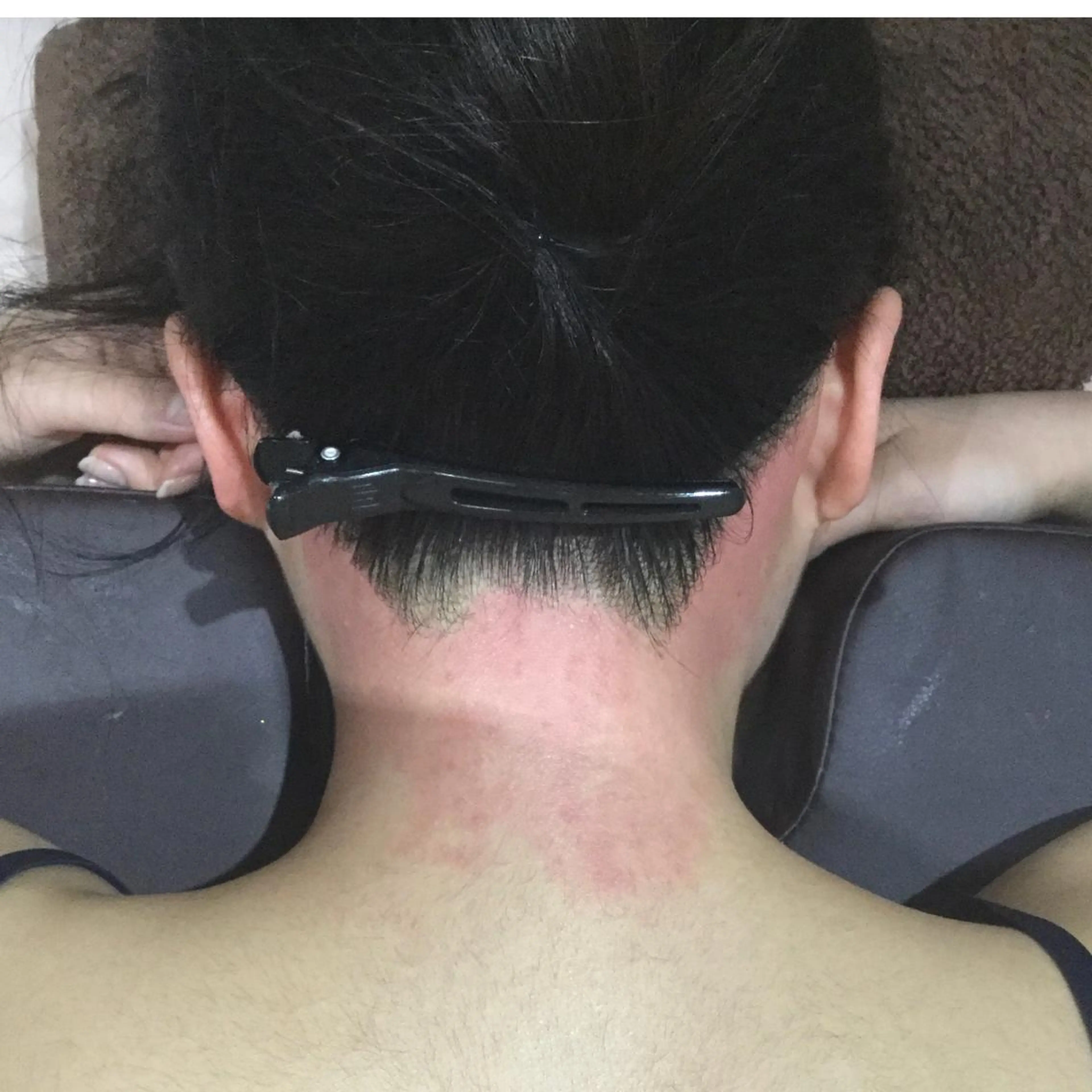 【女性wax】うなじ襟足の写真