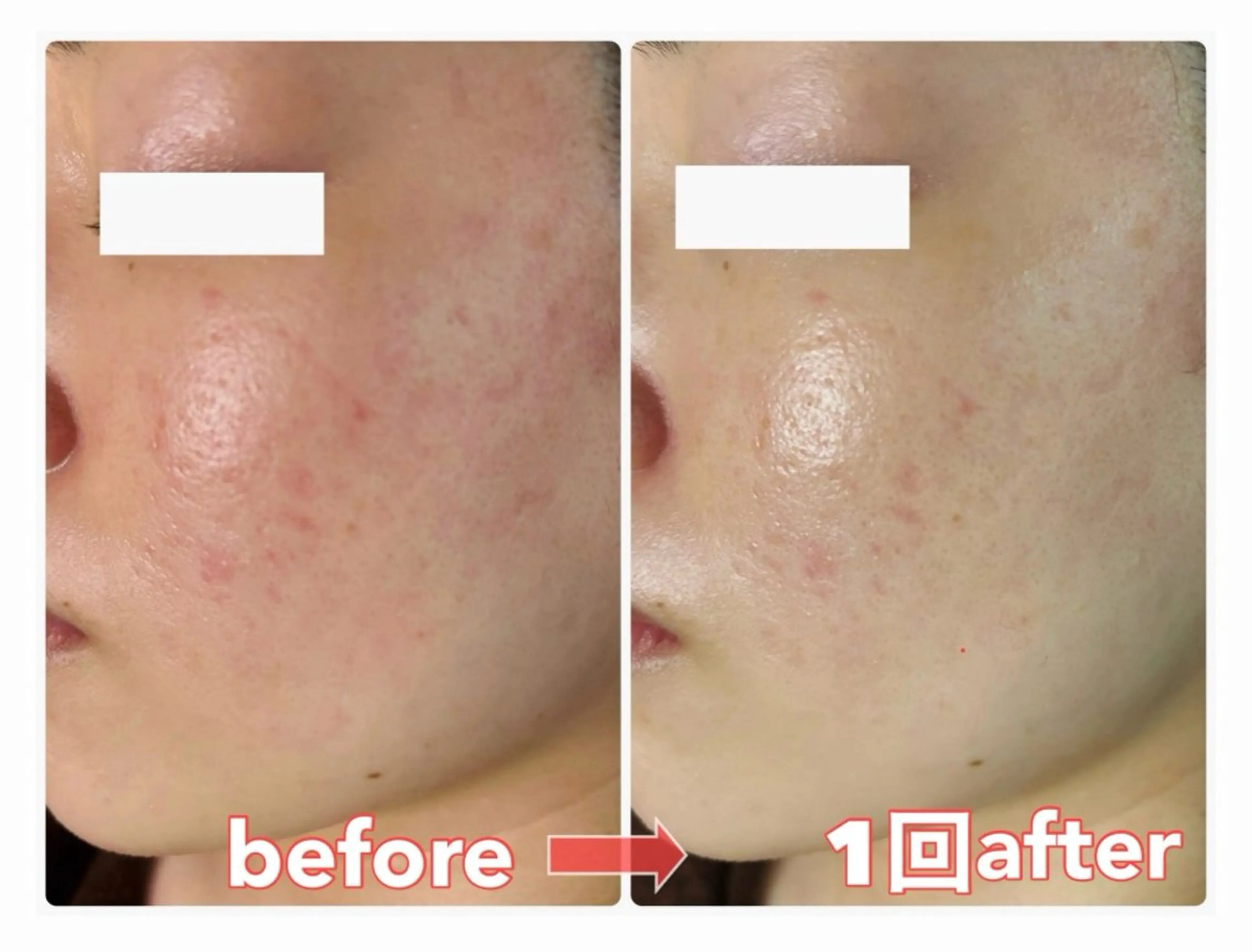 エステ 美ola ビオラのエステ・リラクイメージ