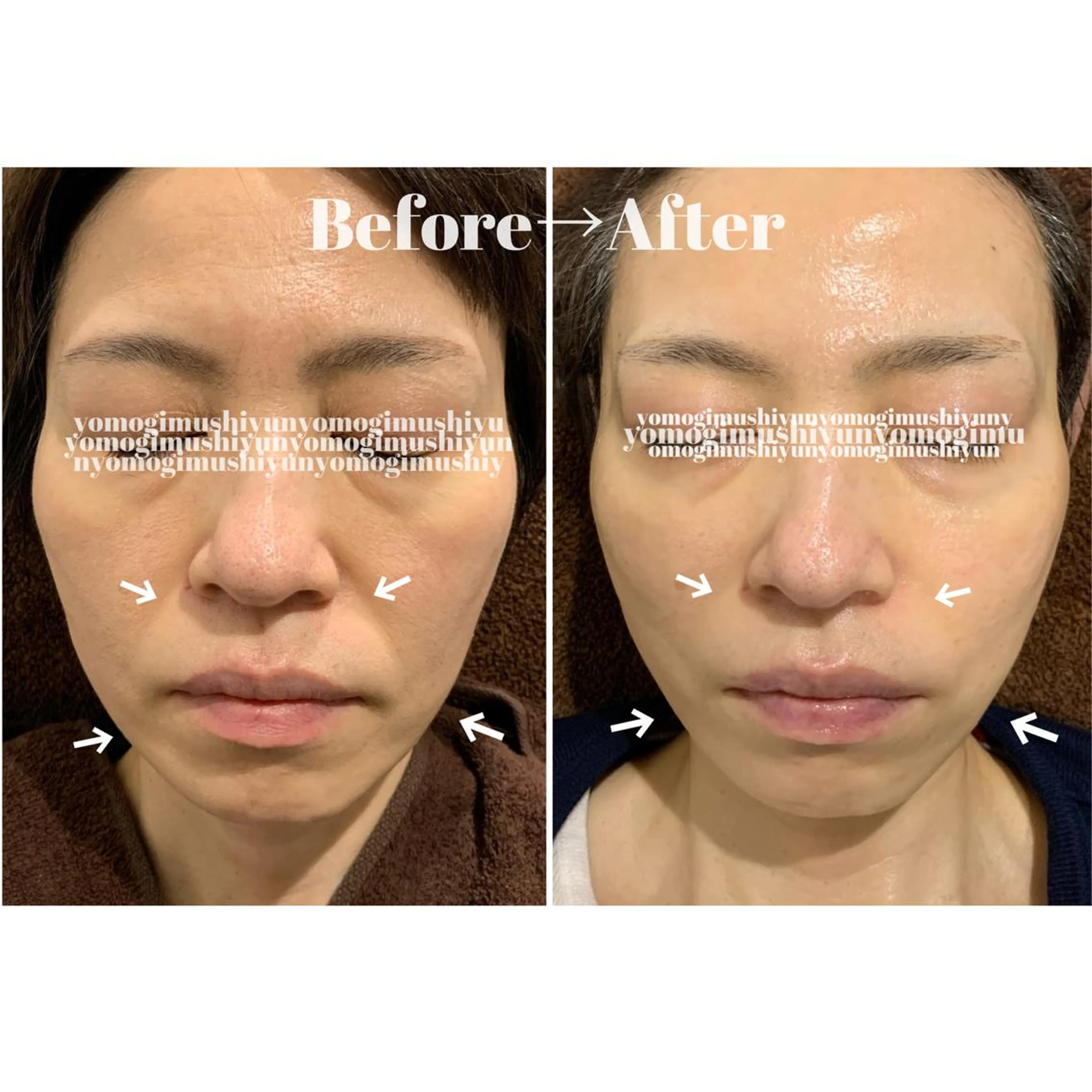 エステ よもぎ蒸しエステサロン★yun所属・よもぎ蒸しサロン ゆんのエステ・リラクイメージ