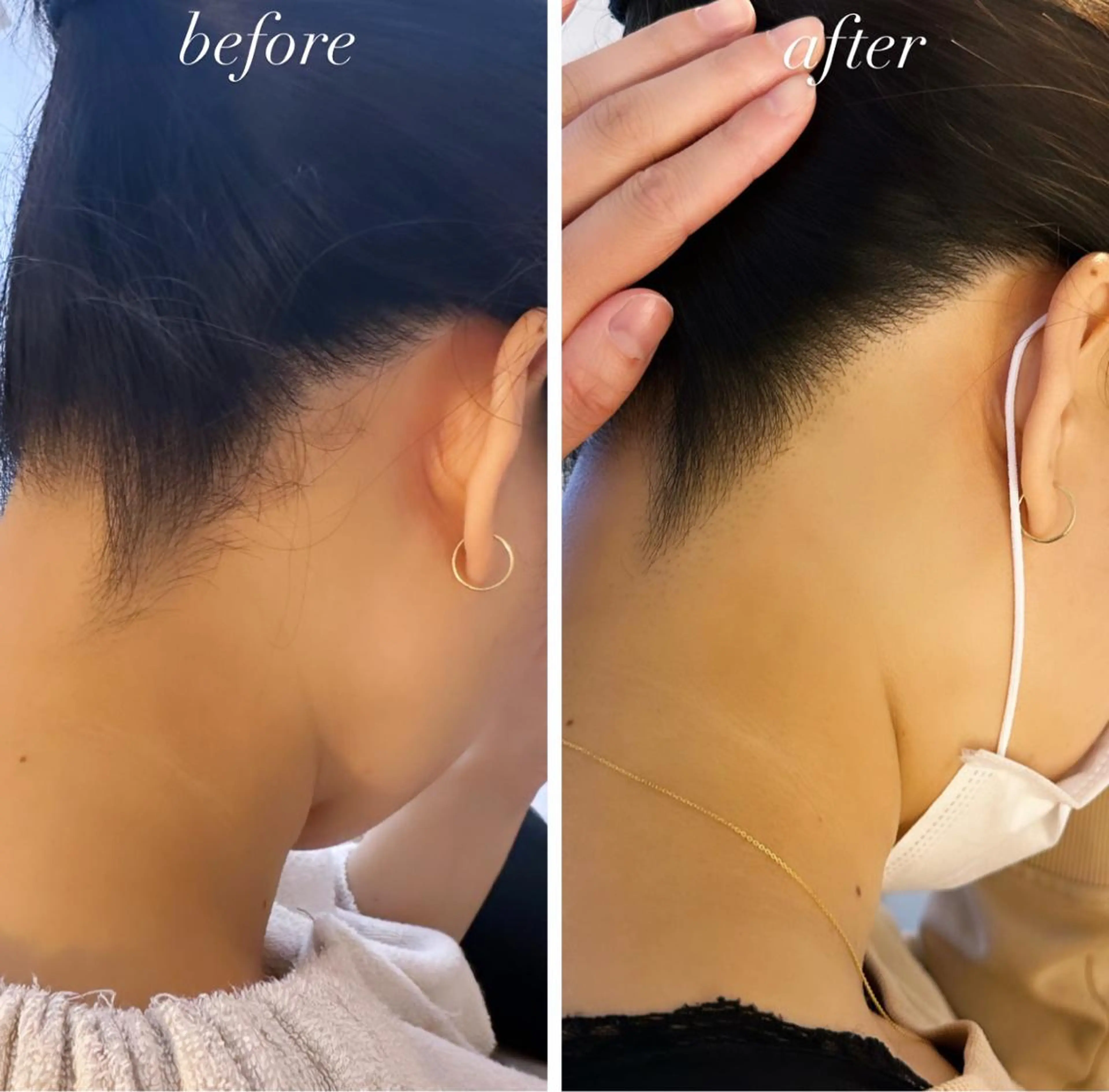 うなじ脱毛/美肌脱毛 LABELのエステ・リラクイメージ