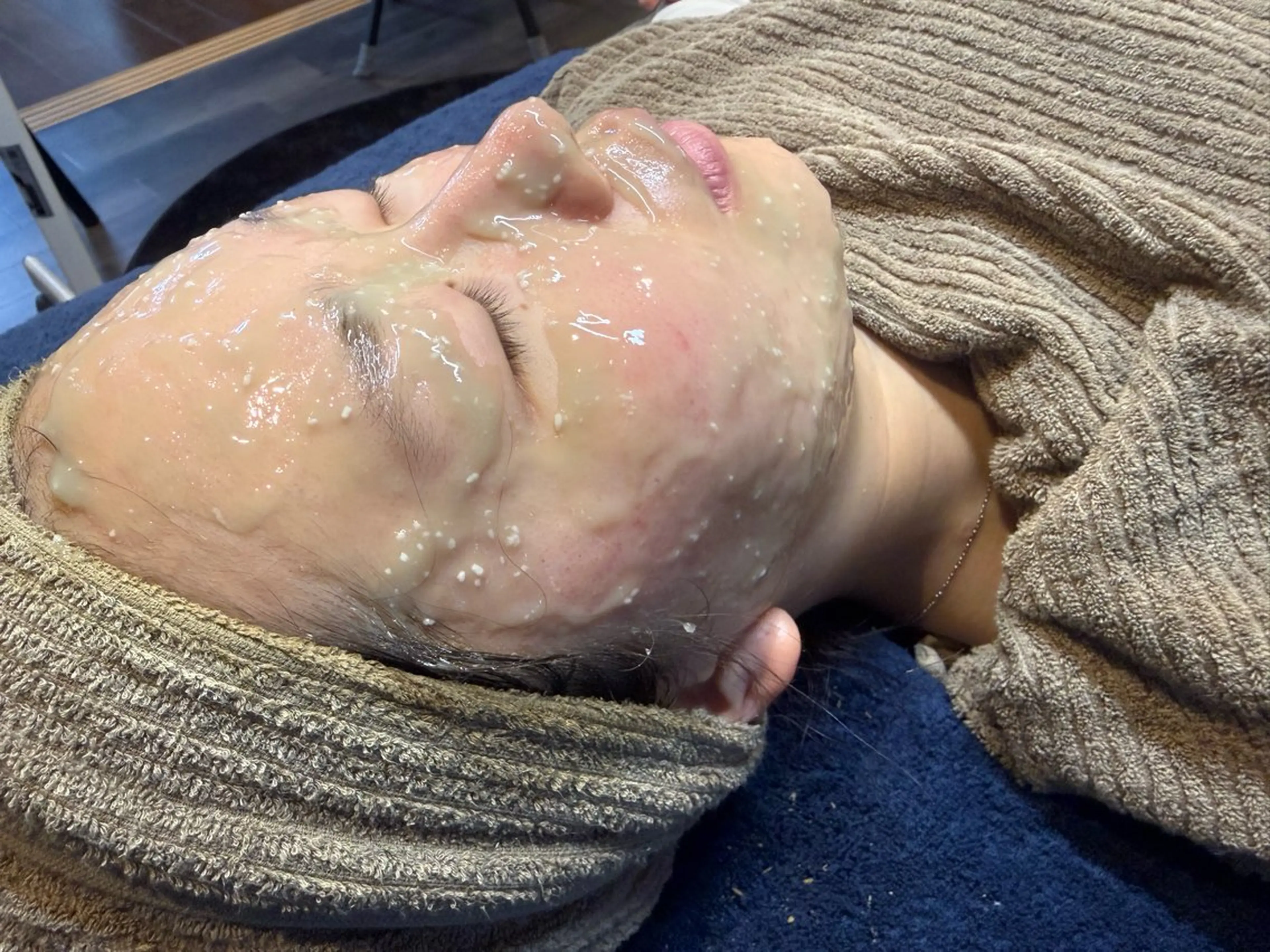 スペシャルケア🌿🫧毛穴洗浄➕剥離なし国産ハーブピーリング➕炭酸ガスハーブパックの写真