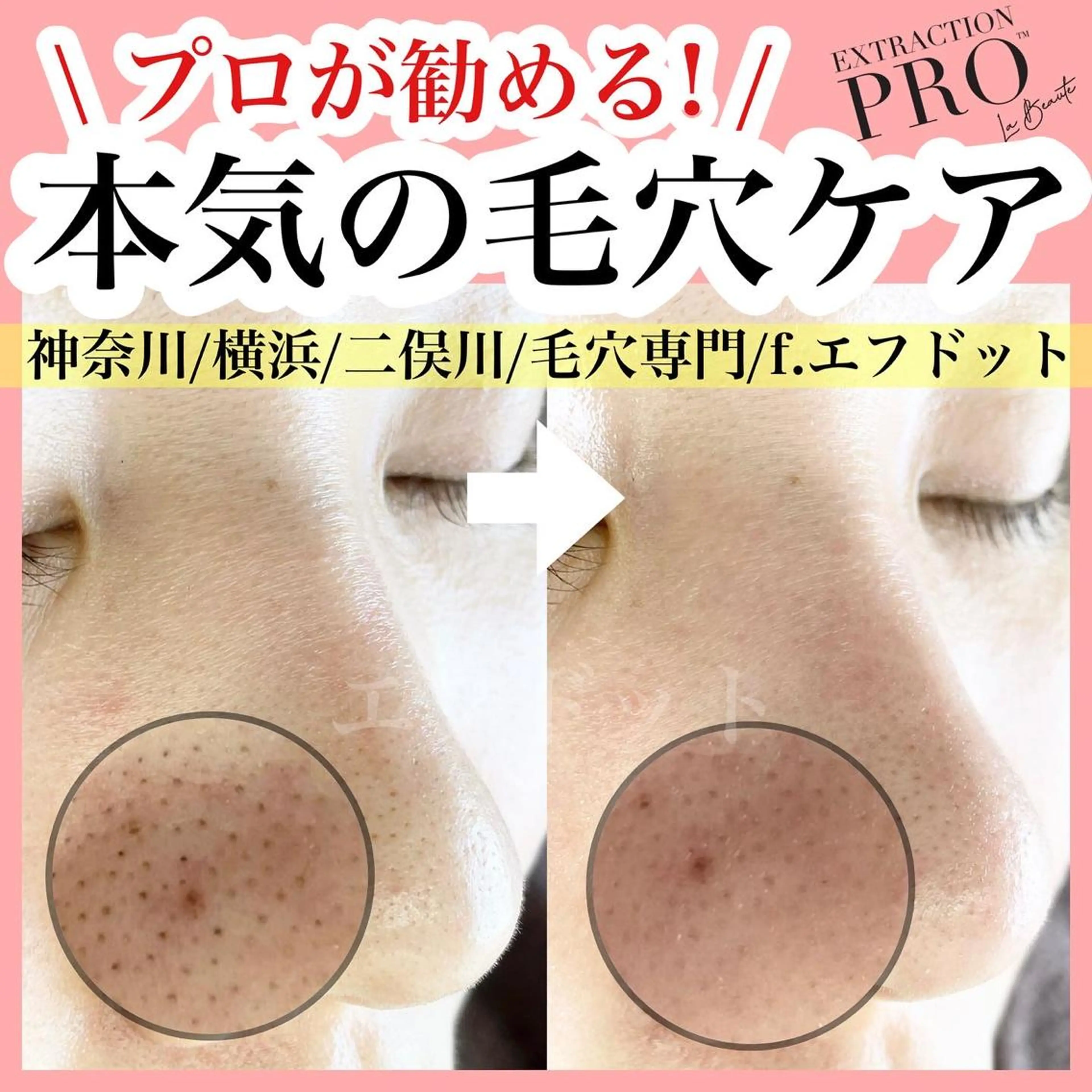 f.【エフドット】 二俣川のマツエク・マツパデザイン