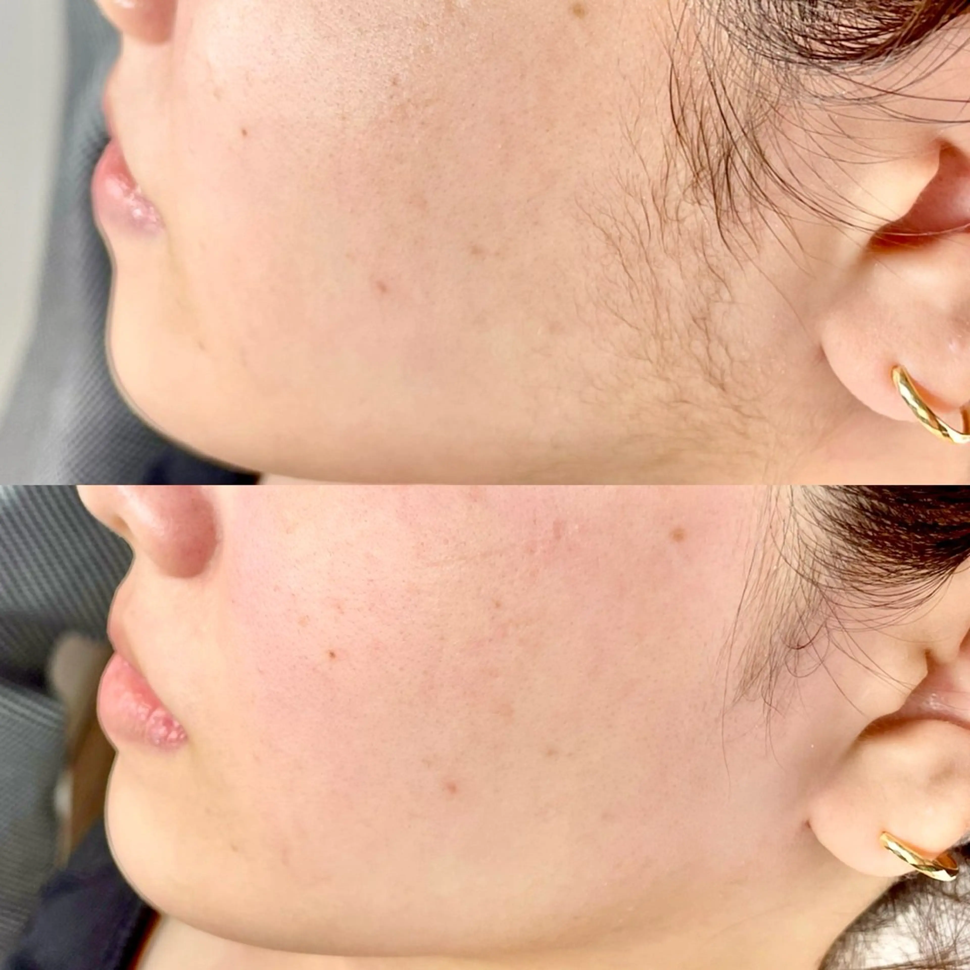 🧚🏻‍♀️【OPEN記念◎3ヶ月限定30%オフ】フェイスwaxの写真