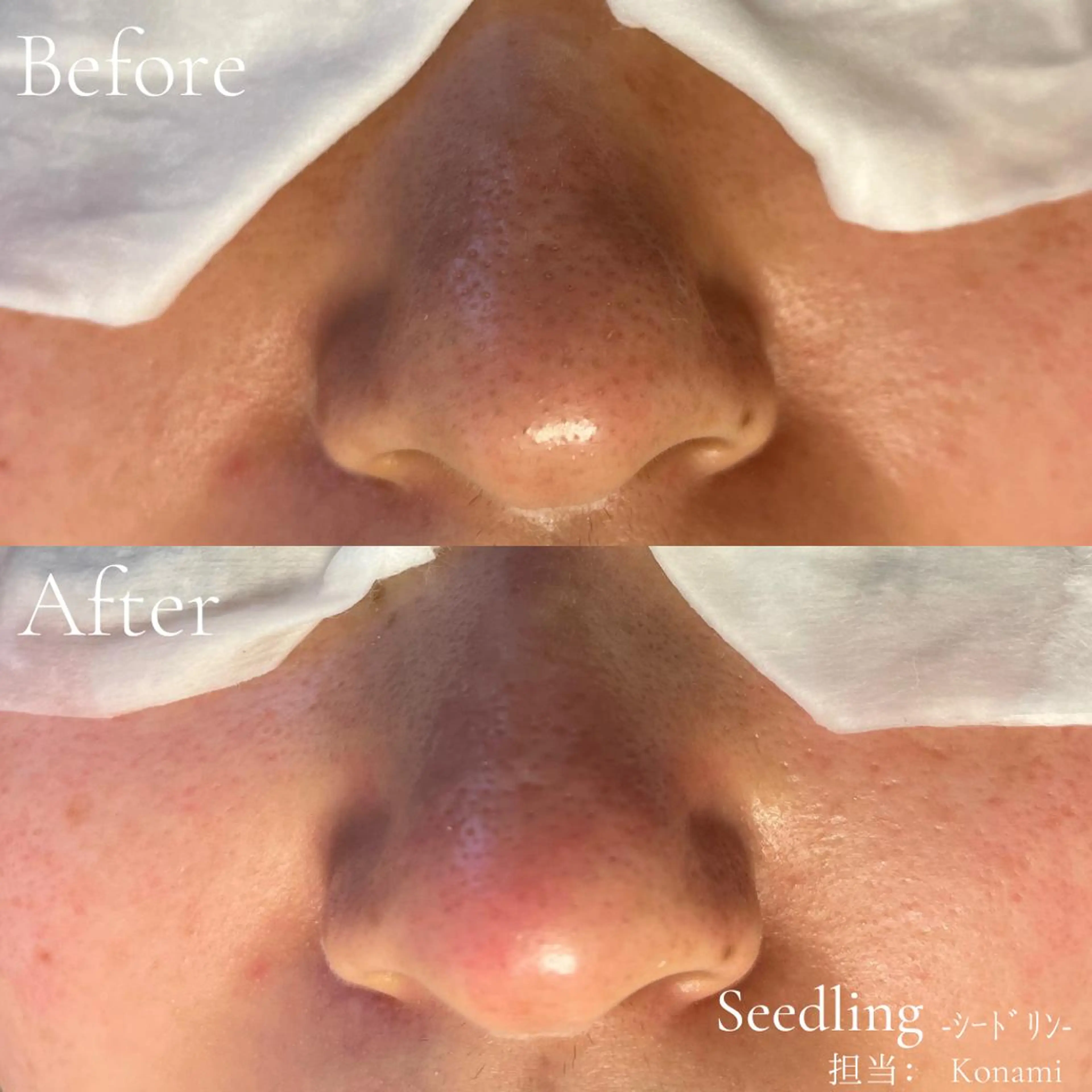 エステ シードリン 府内店 小波のエステ・リラクイメージ