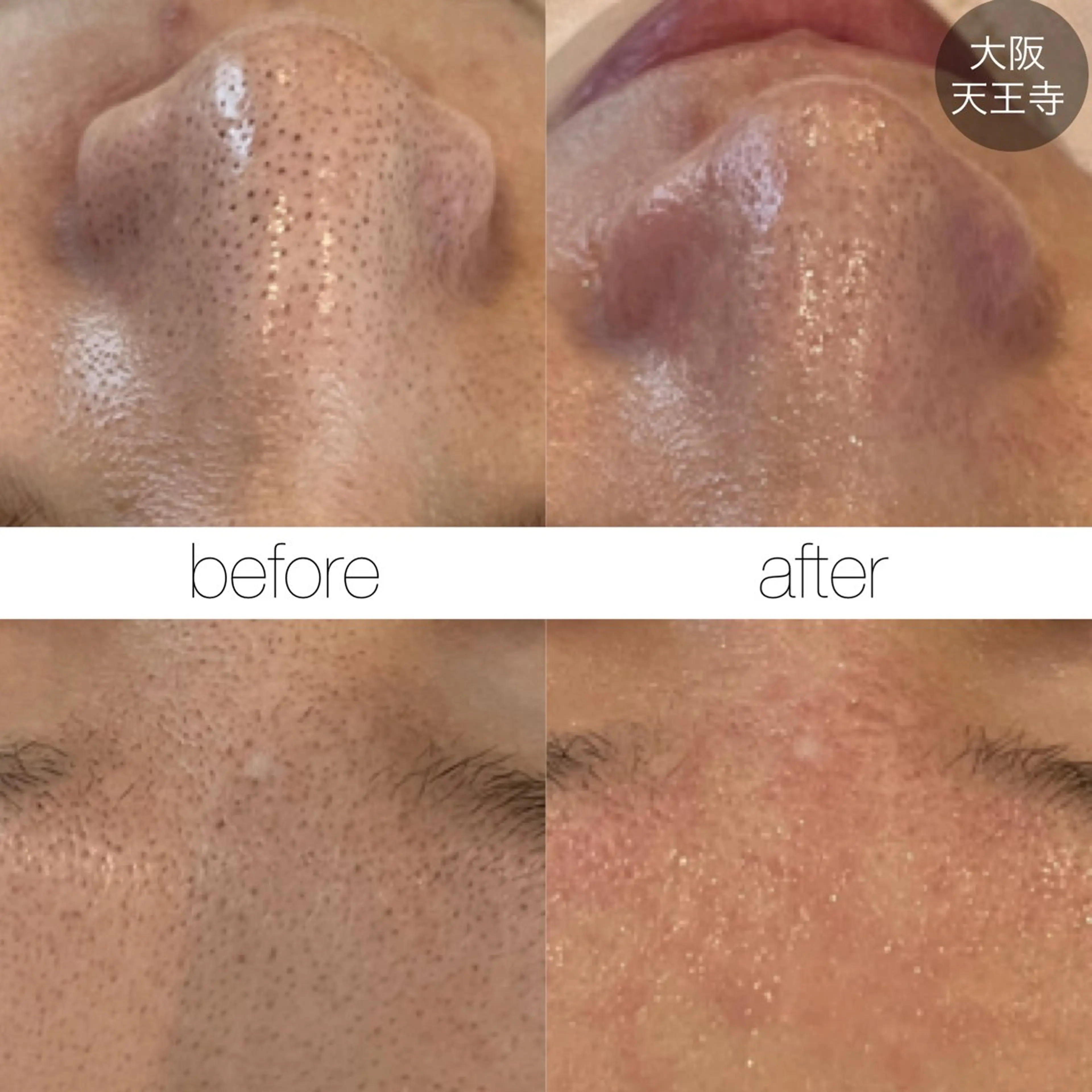 【しみ毛穴専門店】beautysalon Ankh所属・しみ毛穴専門店 Ankh 平田のエステ・リラクイメージ