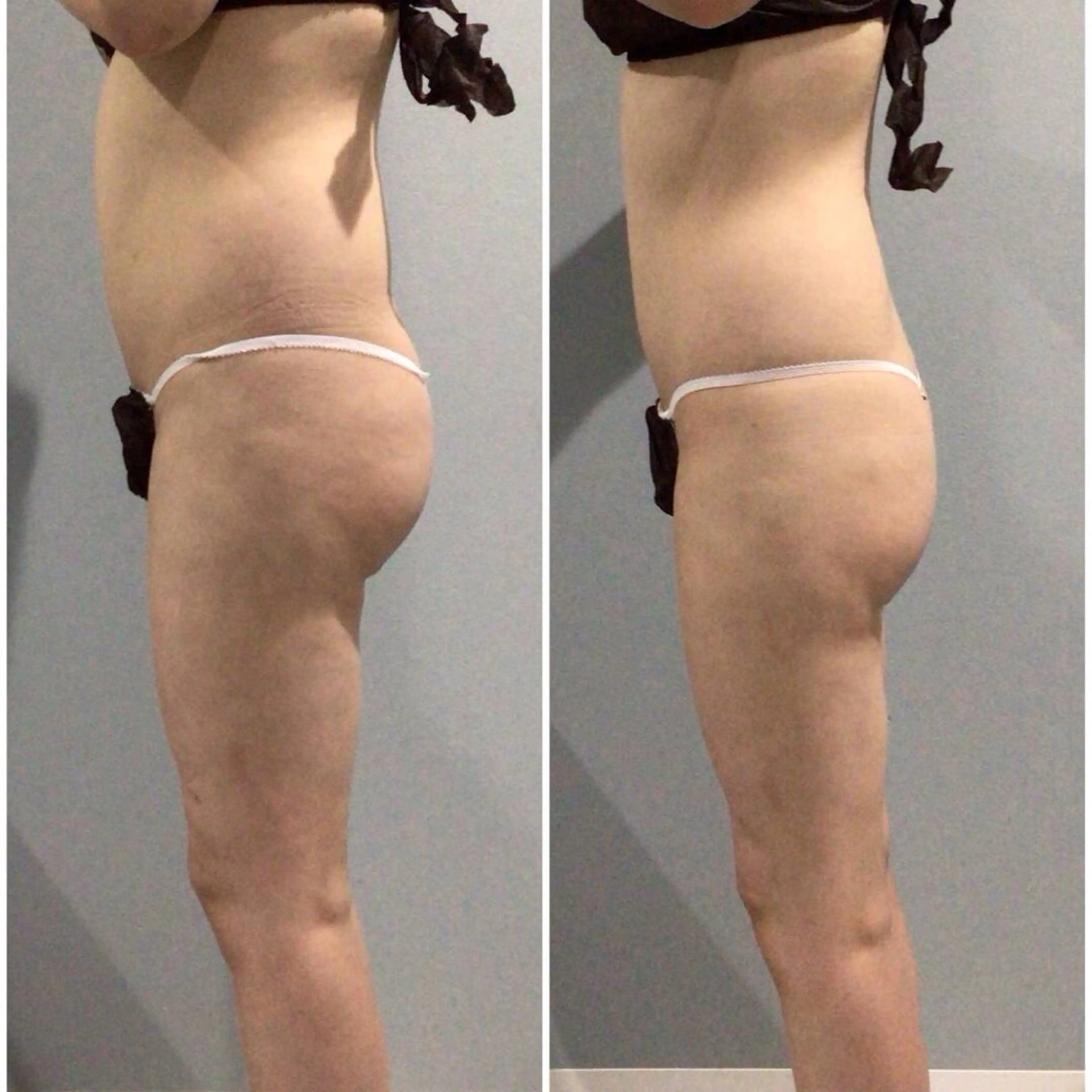 アイアンド ネイルデイのエステ・リラクイメージ