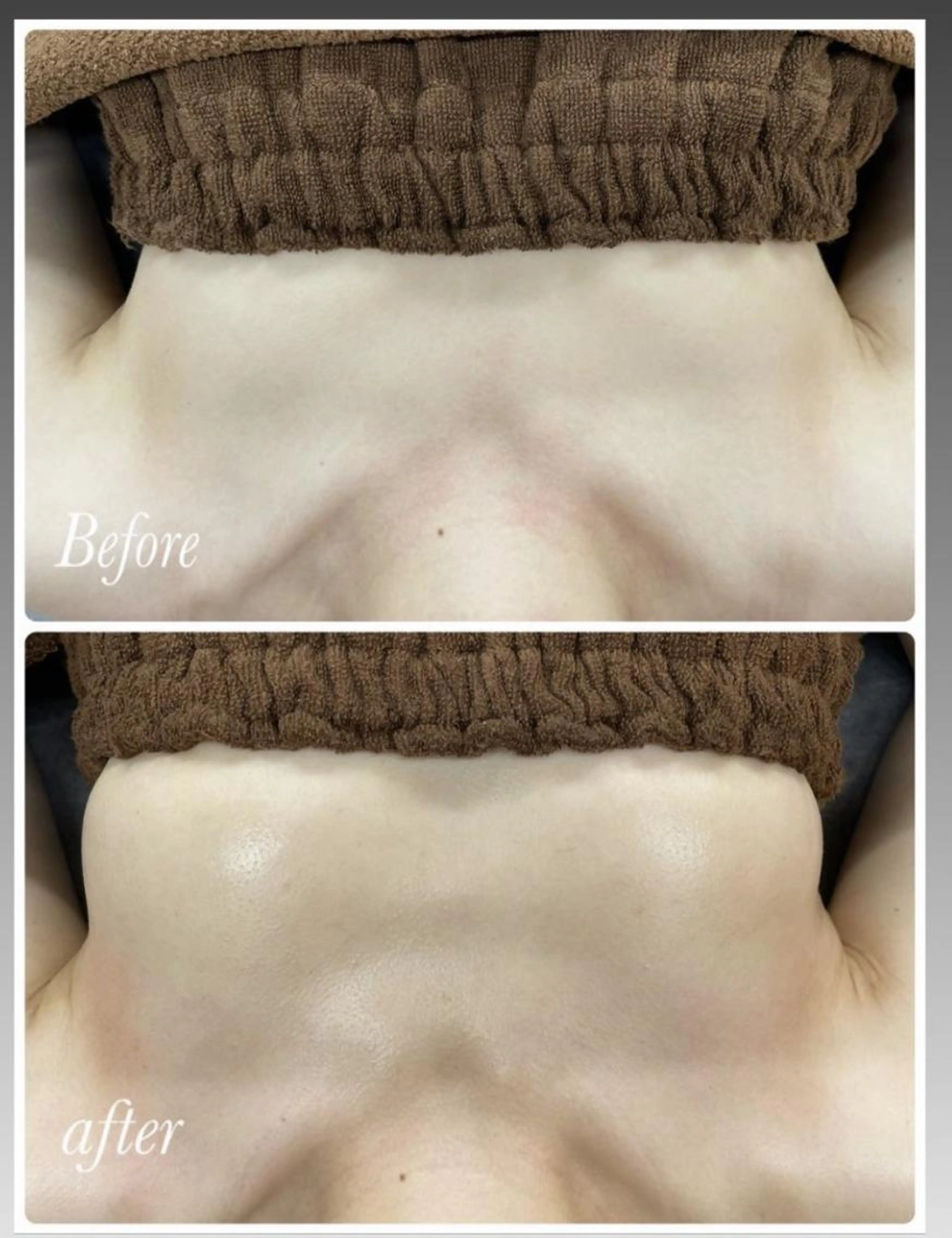 ふわふわバストケア🫶❤️目指せスフレおっぱい&お碗型バスト❗️の写真