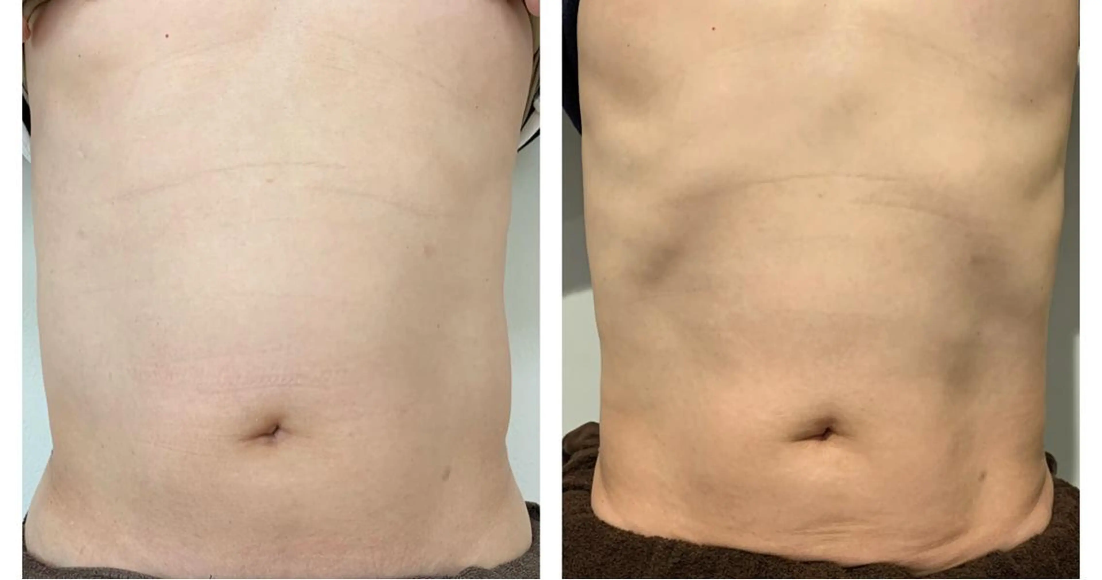 エステ 癒し腸もみサロン シャユーム　ゆきなのエステ・リラクイメージ