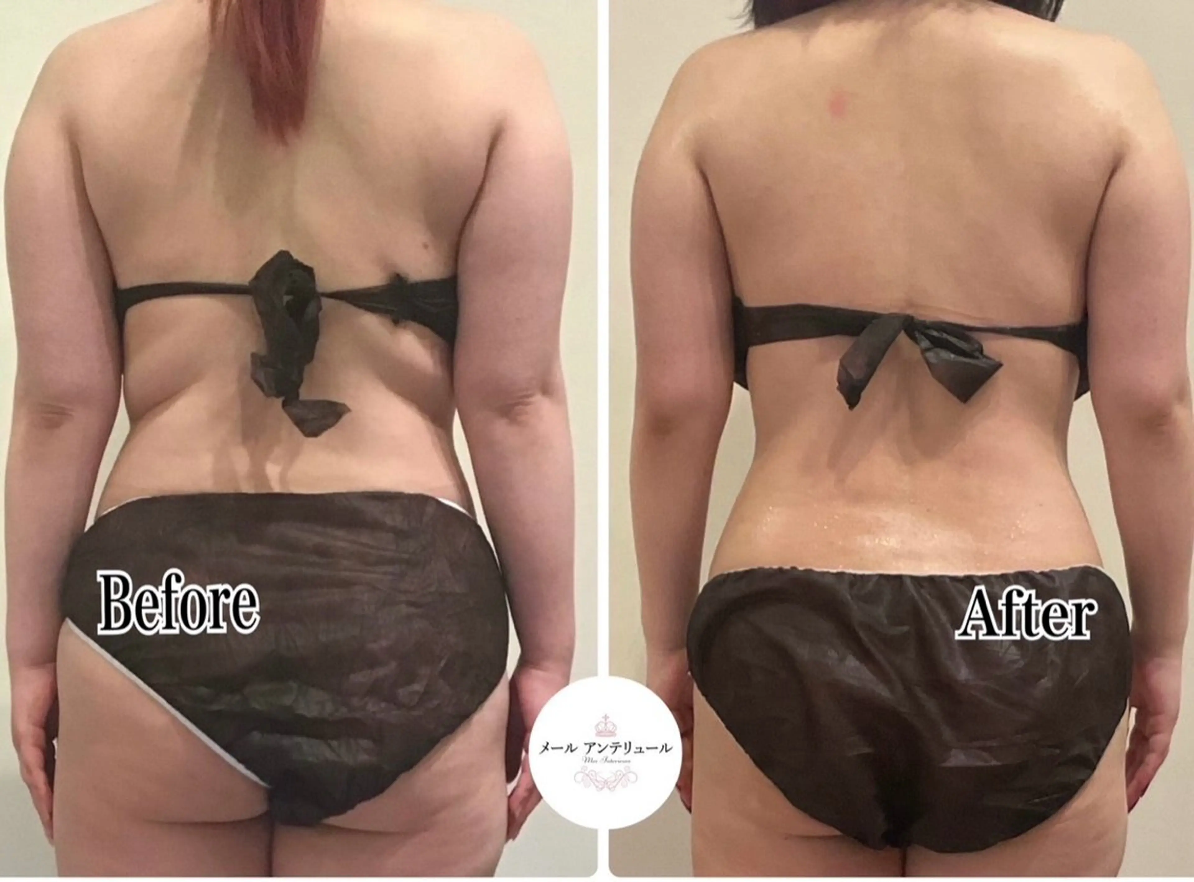 メールアンテリュール 佐野のエステ・リラクイメージ