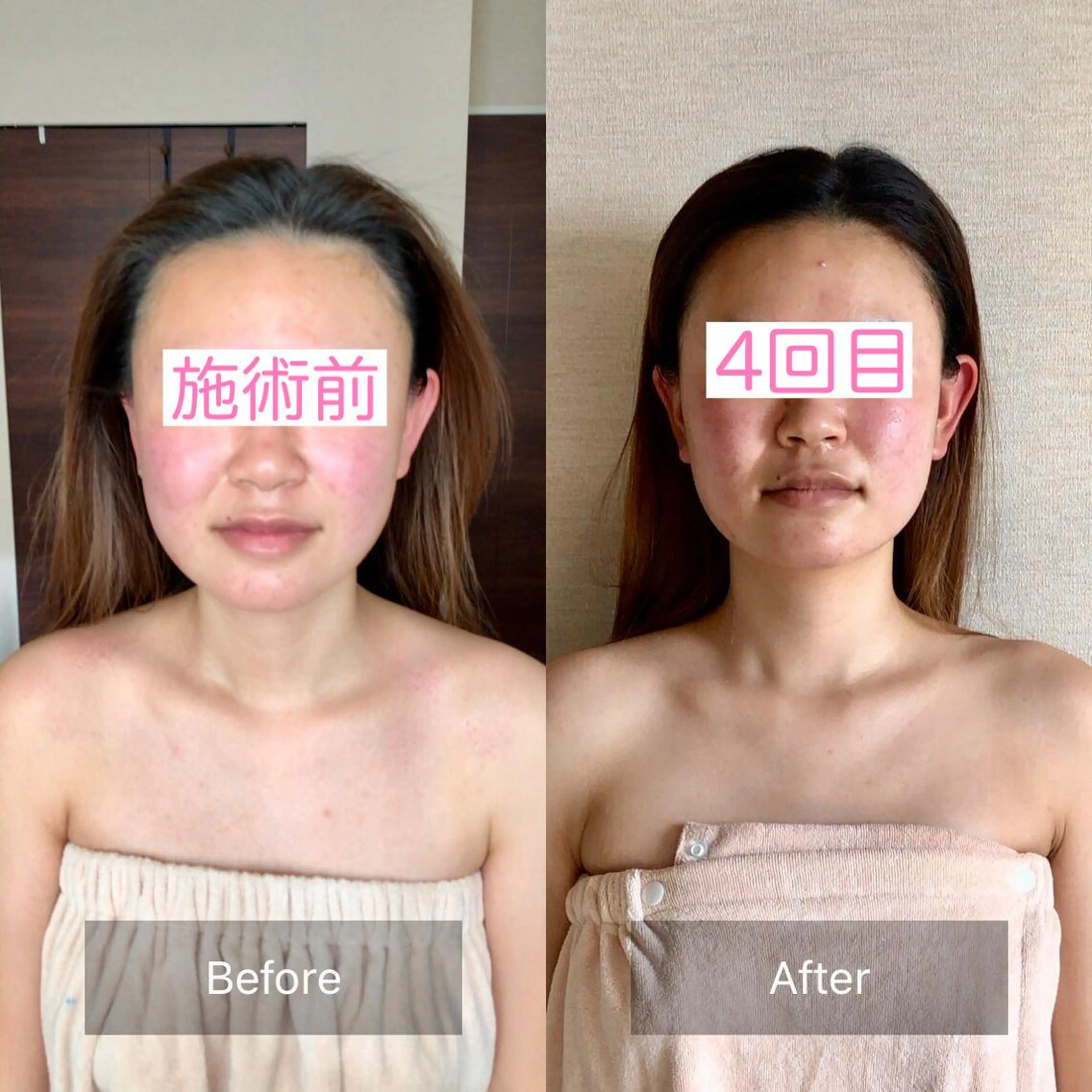 エステ リラク 小顔&ヘッドスパ haruhandのエステ・リラクイメージ