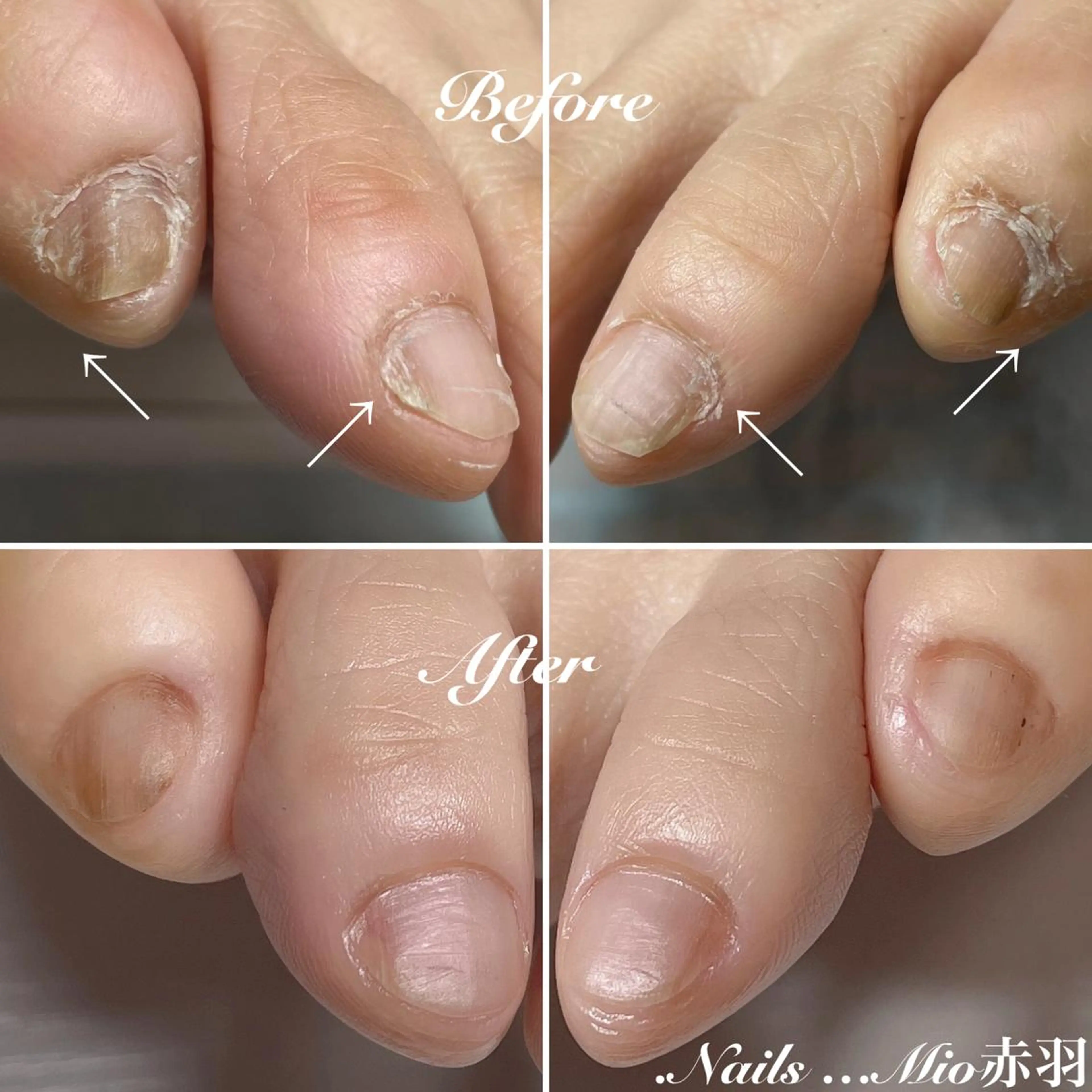 ネイル フットネイル .Nails Mio 赤羽西ネイルサロンのネイルデザイン