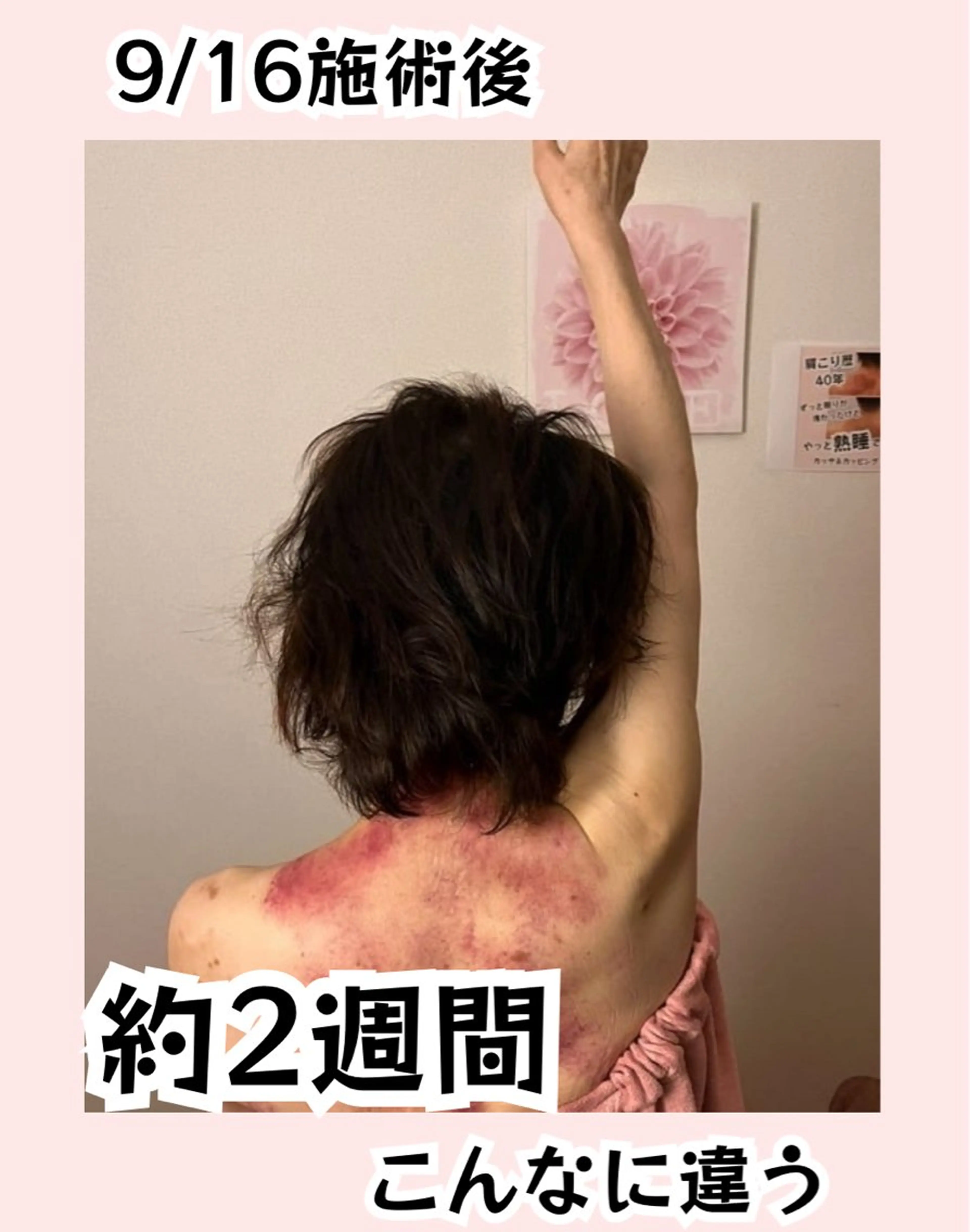 ドライヘッドスパ KilaKilaのエステ・リラクイメージ