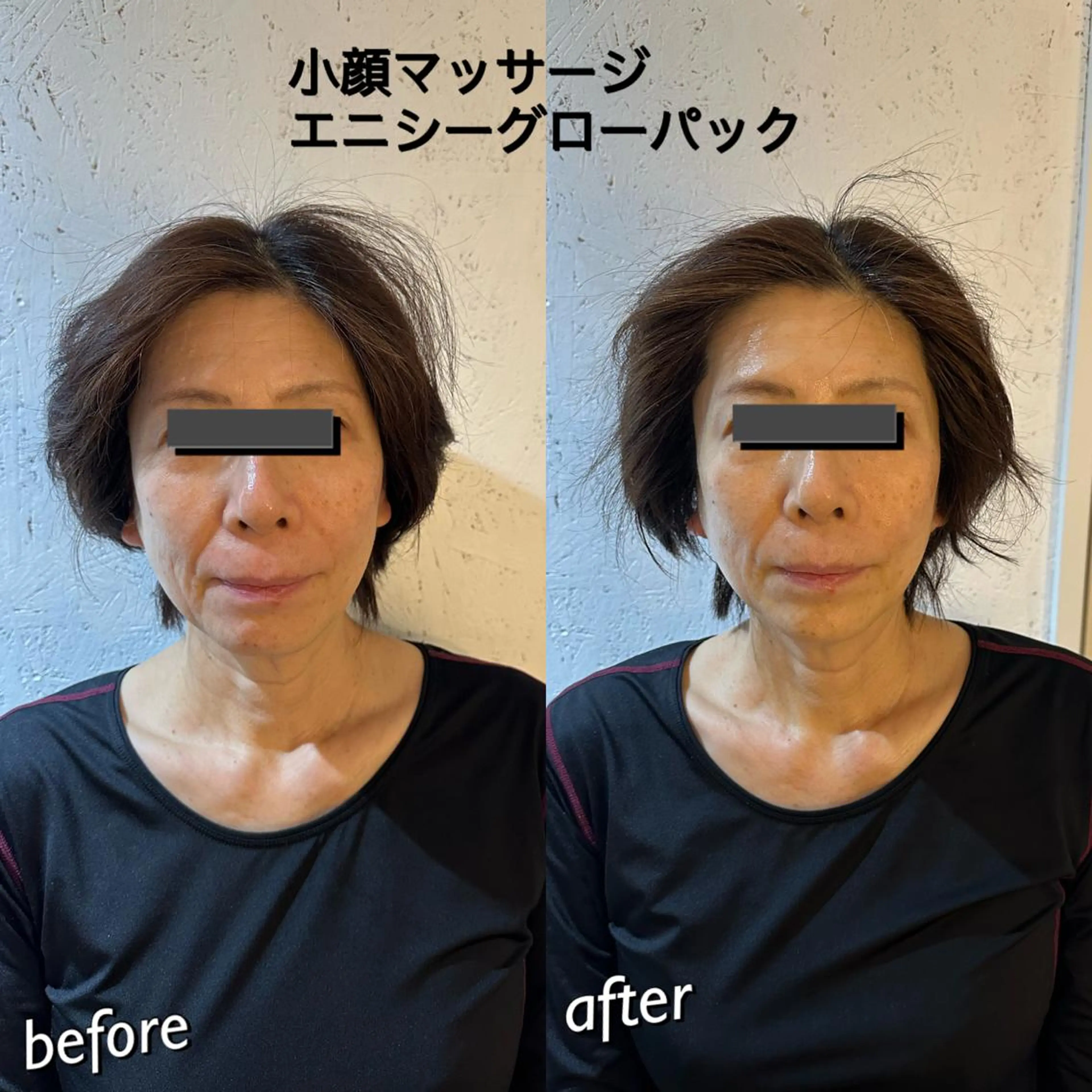 うなじ脱毛/美肌脱毛 LABELのエステ・リラクイメージ