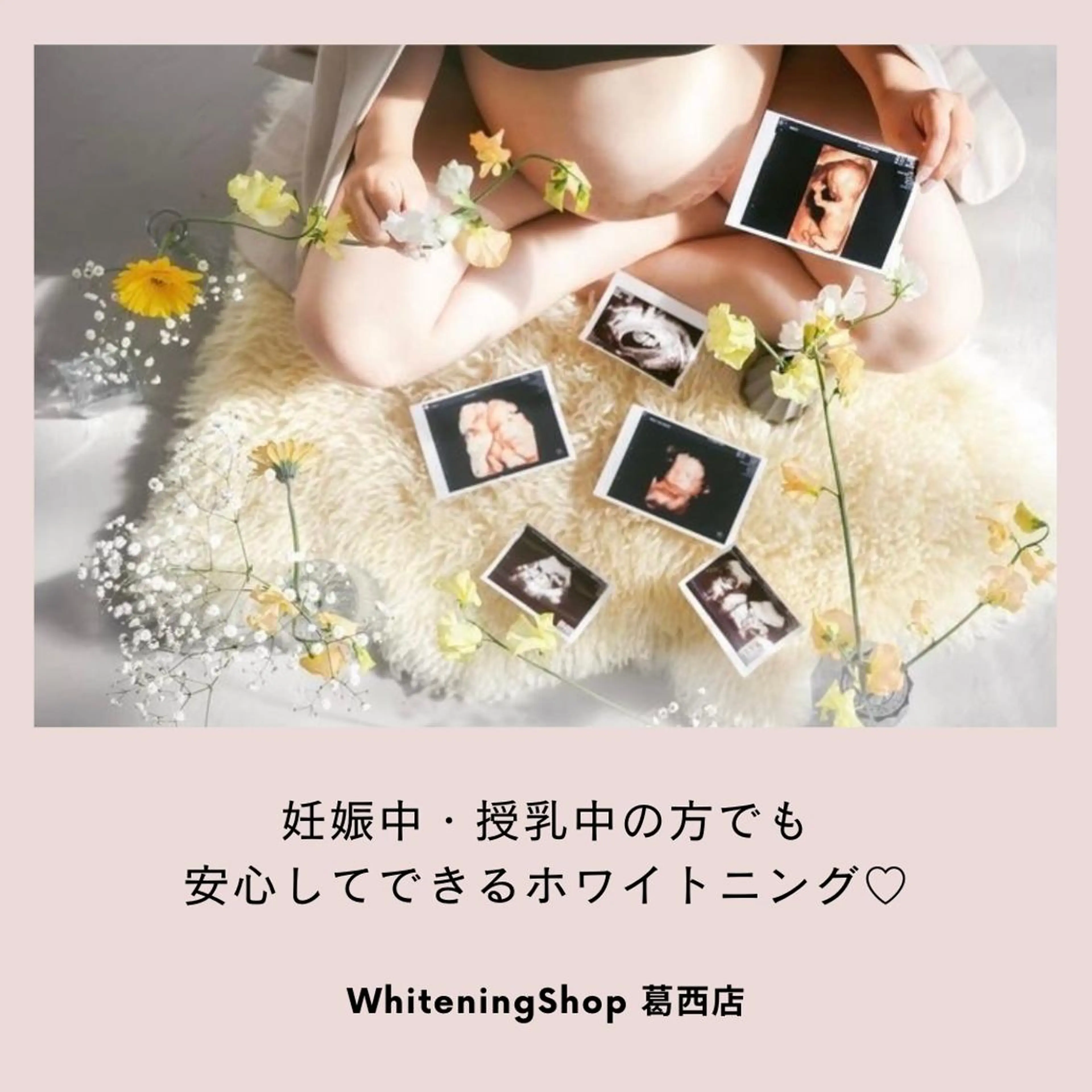 メンズ その他 ホワイトニング ショップ葛西店のその他イメージ