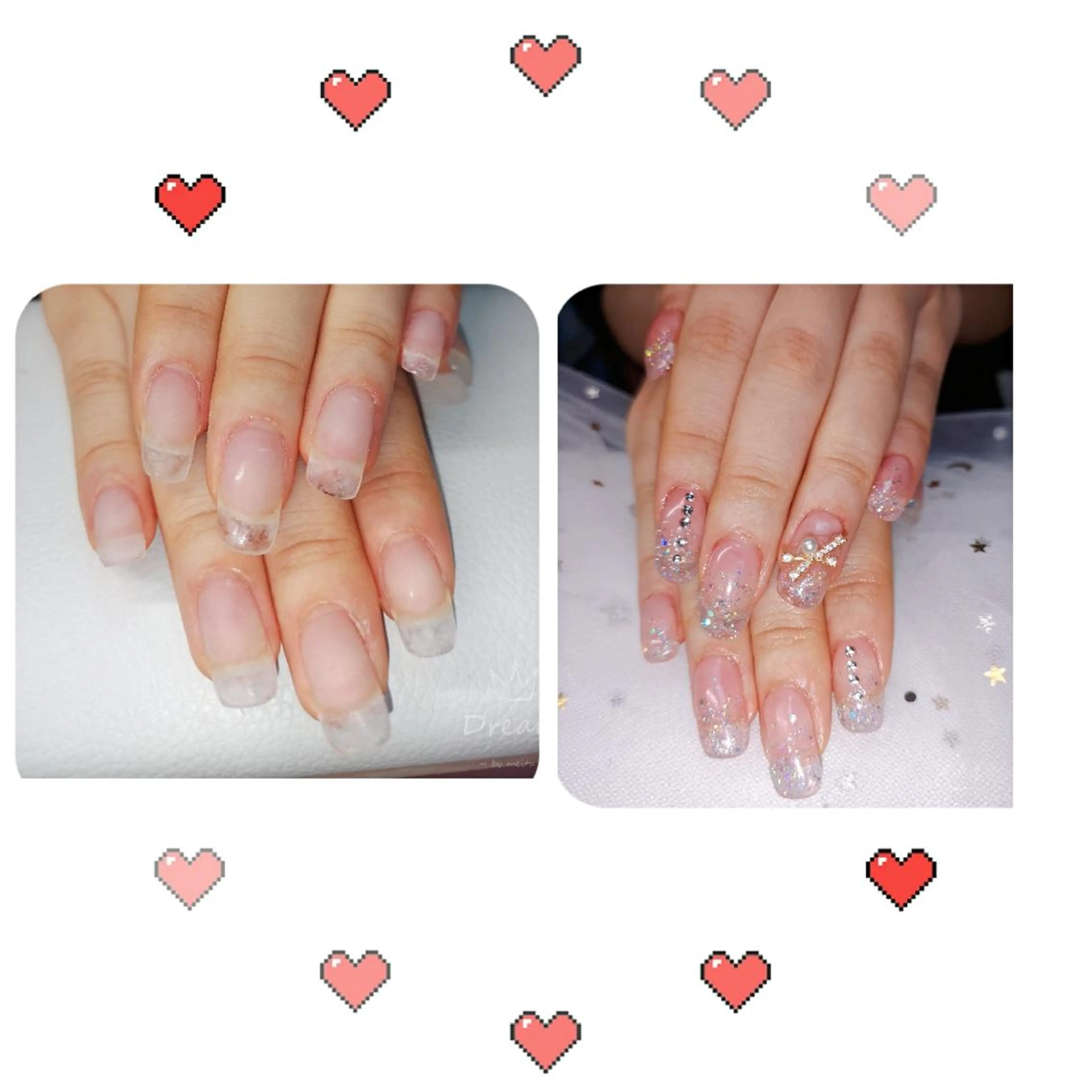 セミロング ネイル ネイリストゆか💅 長さだし、深爪矯正のネイルデザイン