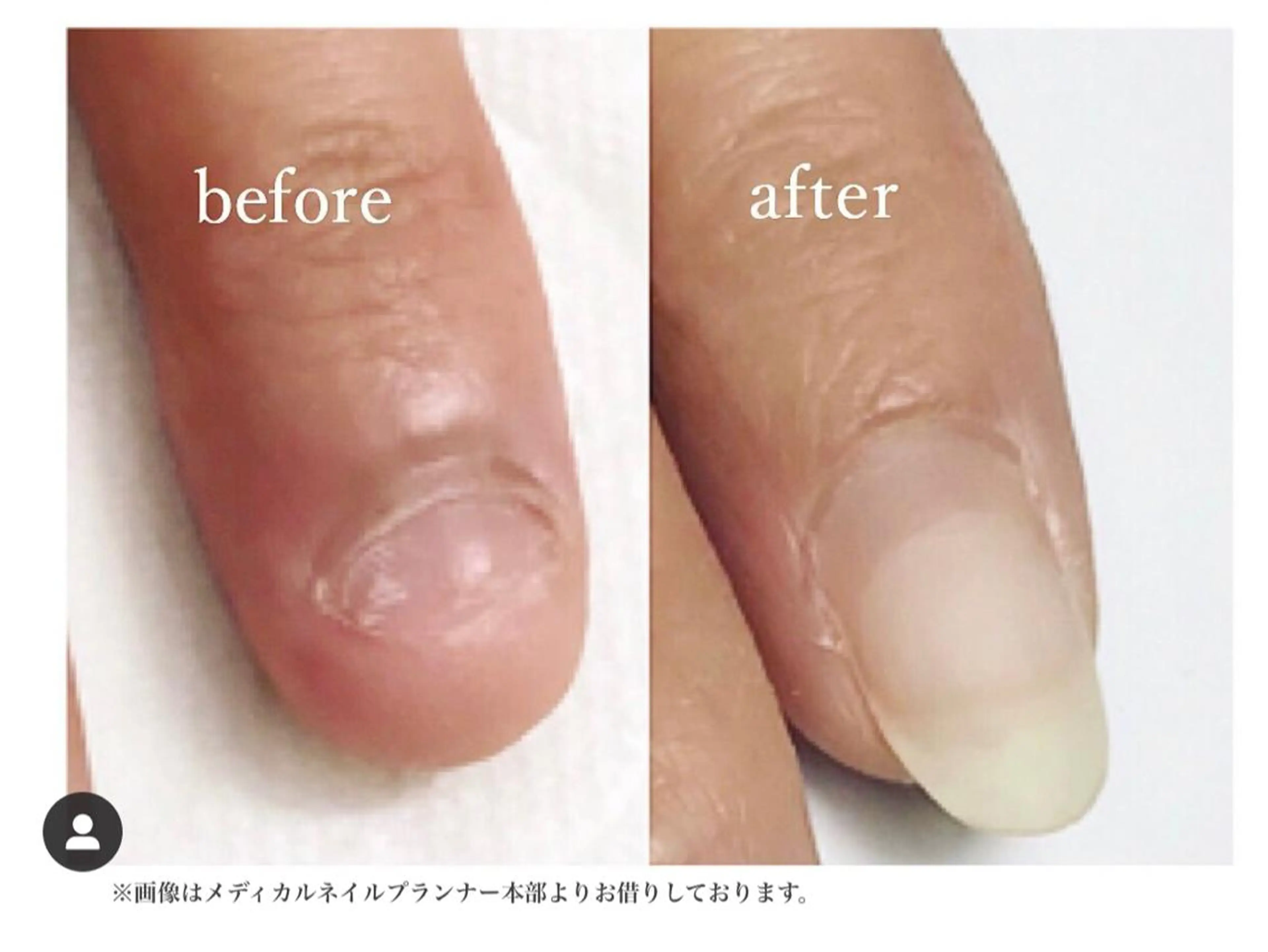 ネイル nailsalon VENUSのネイルデザイン
