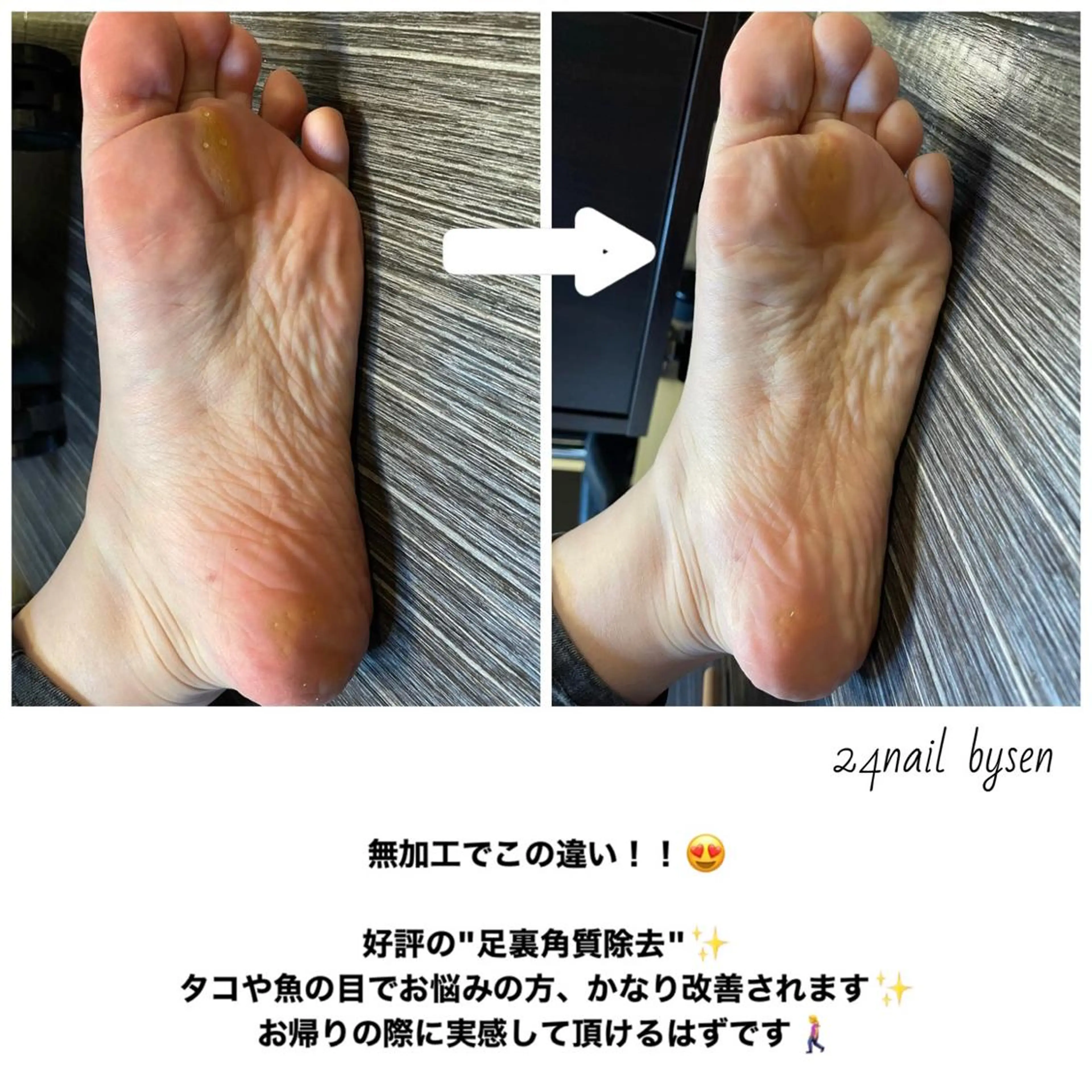 ネイル フットネイル Atelier by 24nail/Ayaのネイルデザイン