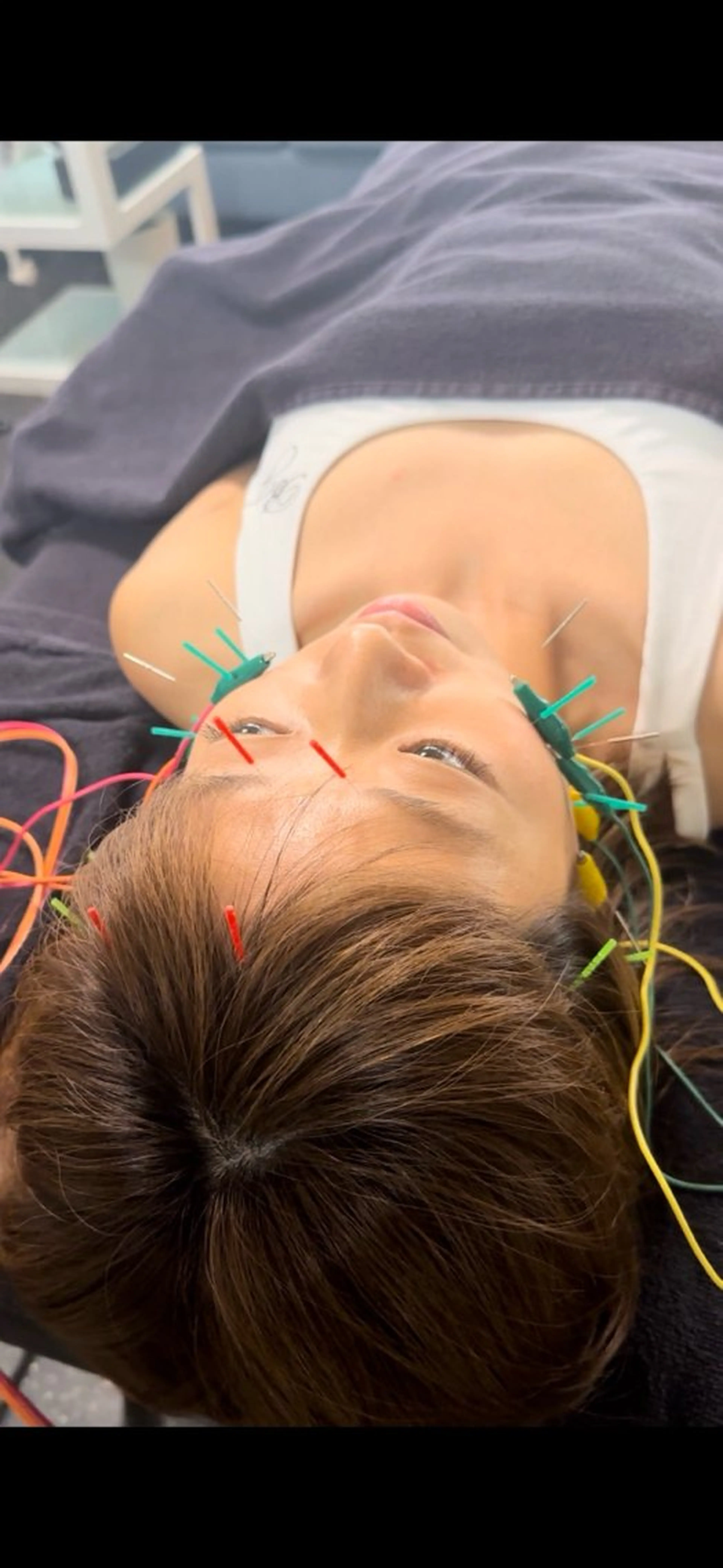 エステ リラク 小顔矯正・美容鍼 FLOW鍼灸整体院のエステ・リラクイメージ