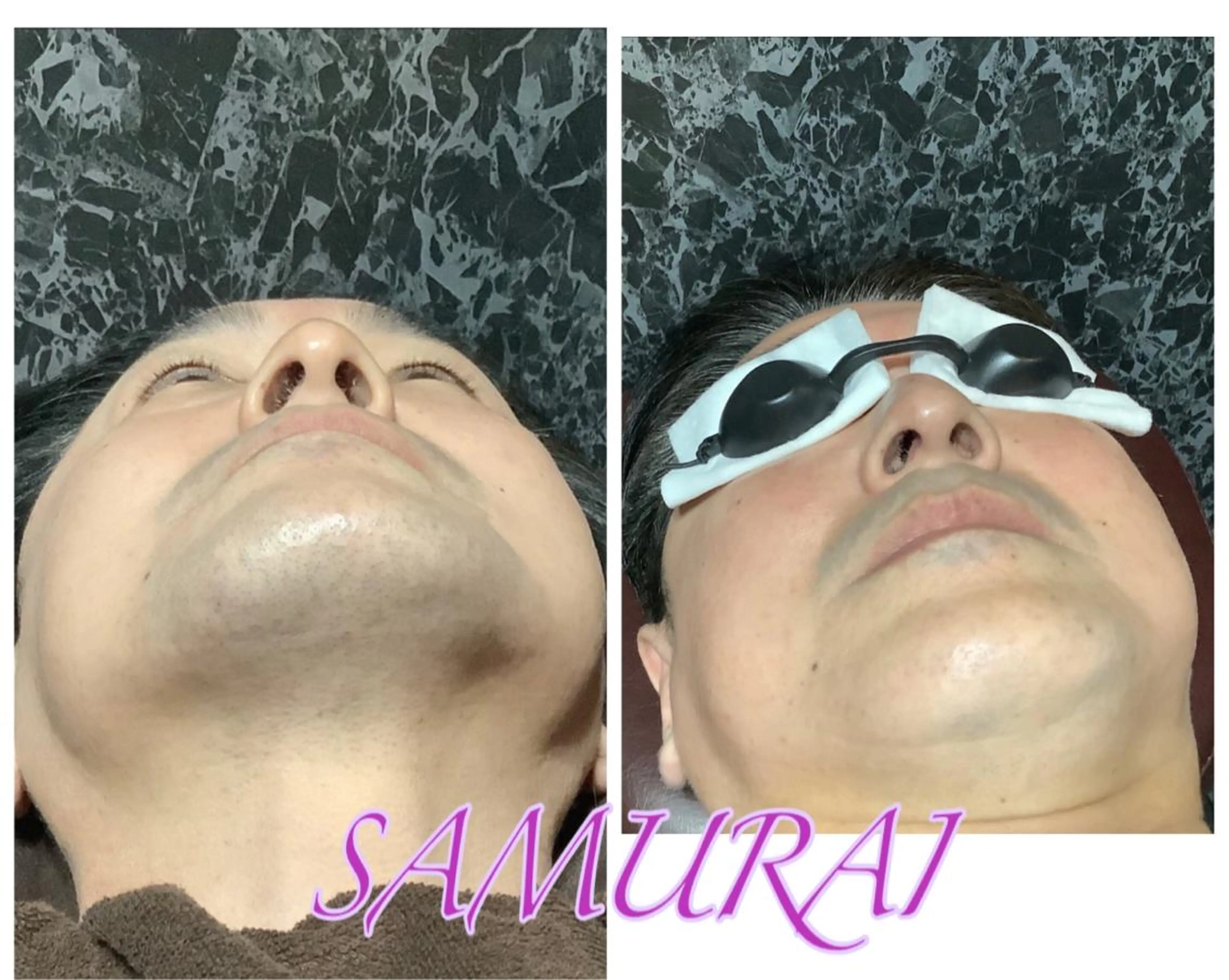 メンズ メンズ専用サロンSAMURAI所属・YAMASHITA HIROKOのエステ・リラクイメージ