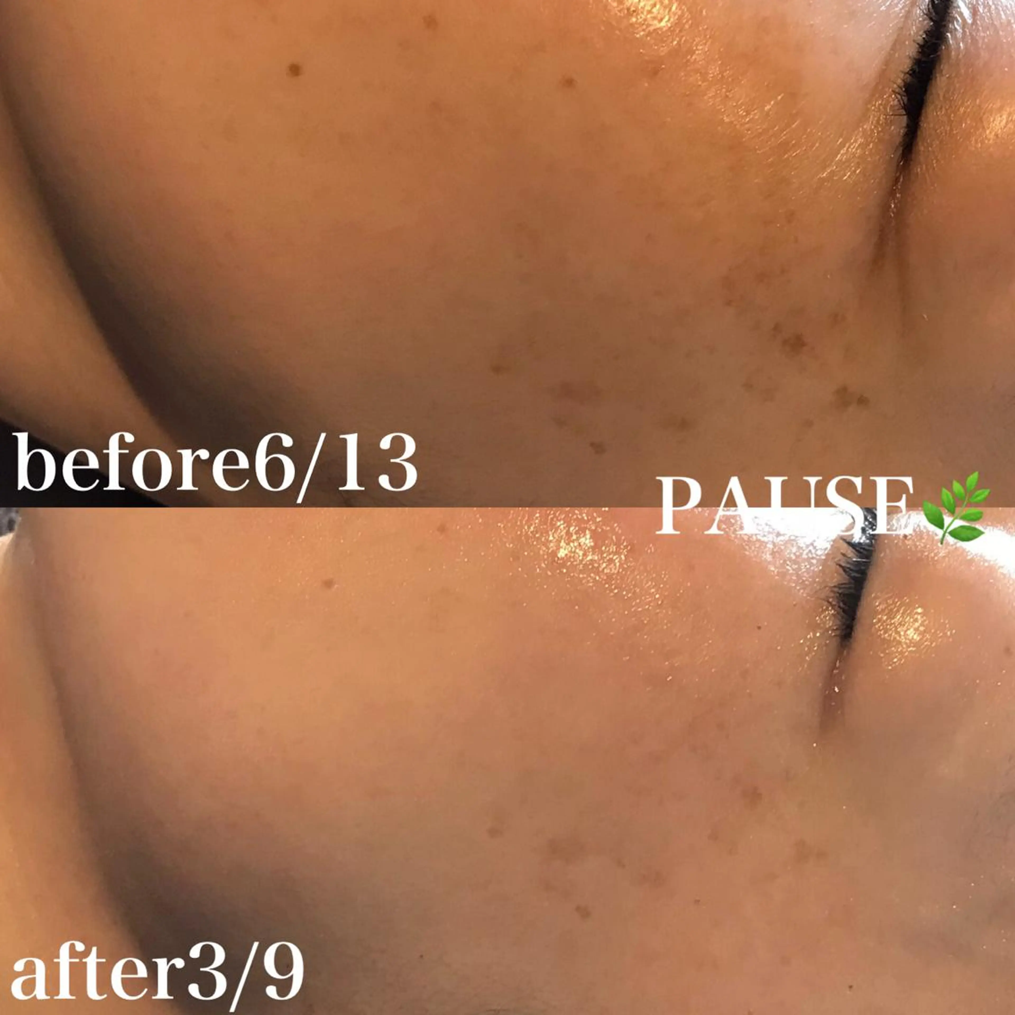 エステ 浜野 恵美のエステ・リラクイメージ