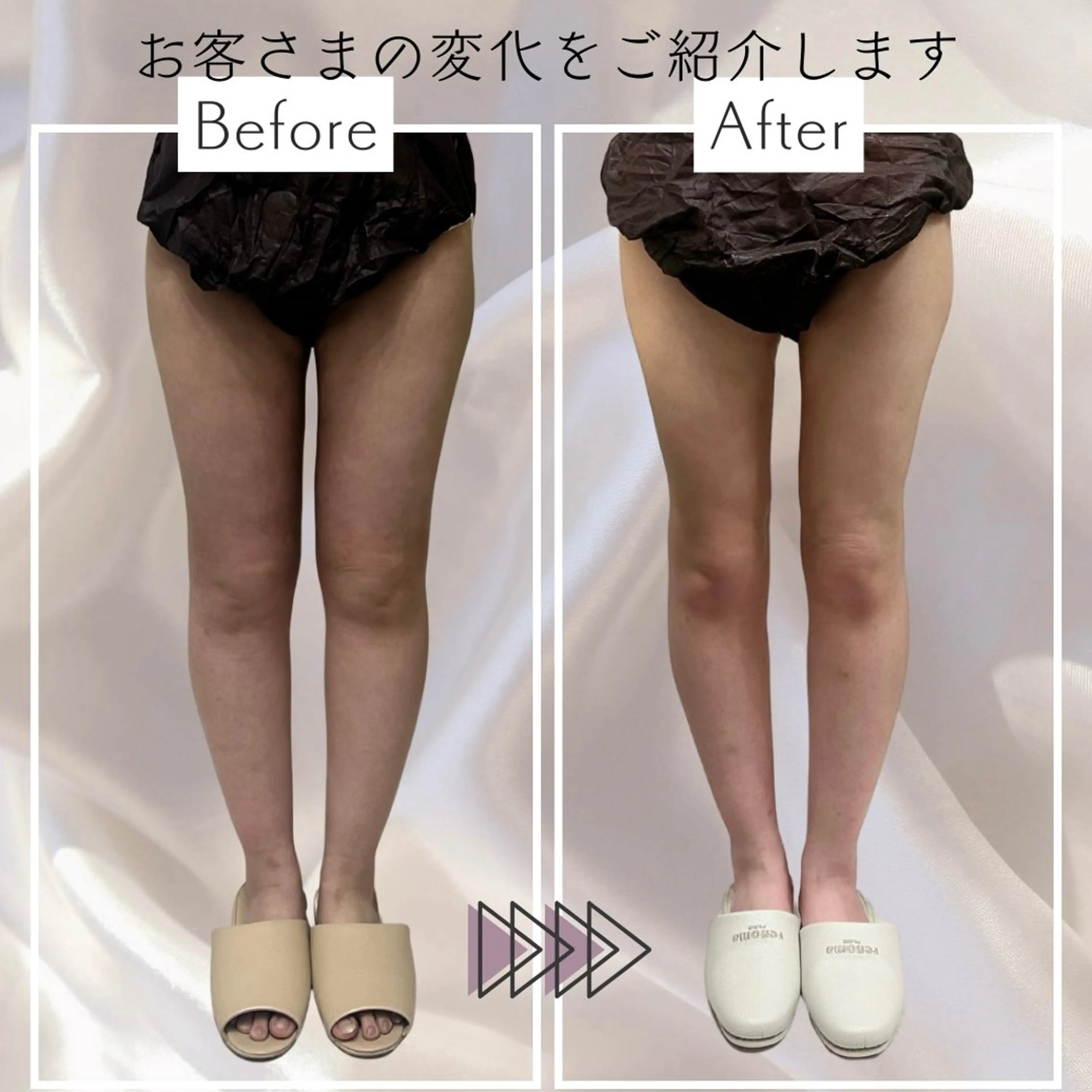 《学割》下半身集中ハイパーナイフ40分！の写真