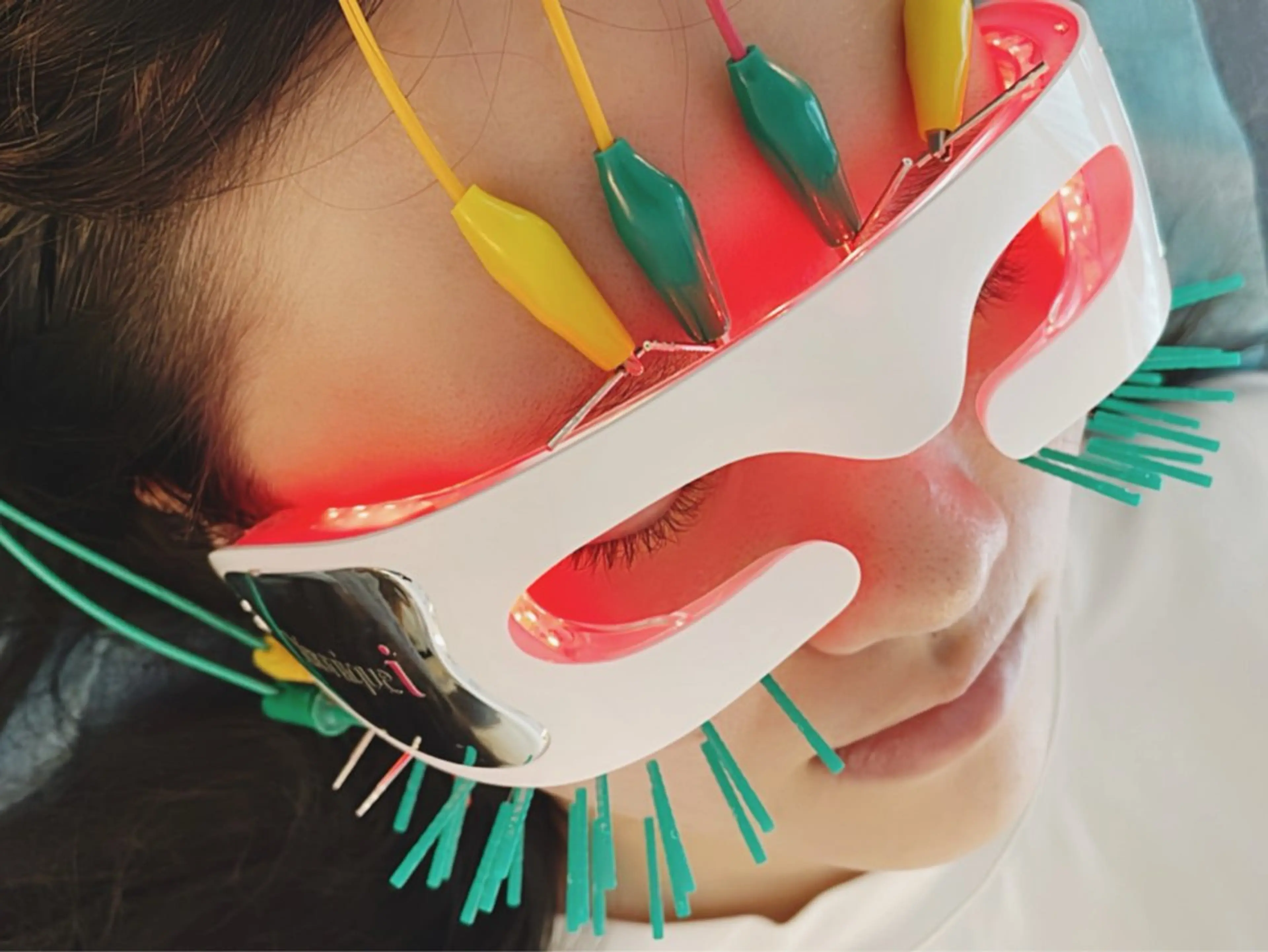 その他 小顔美容鍼専門サロン 渋谷YZのエステ・リラクイメージ