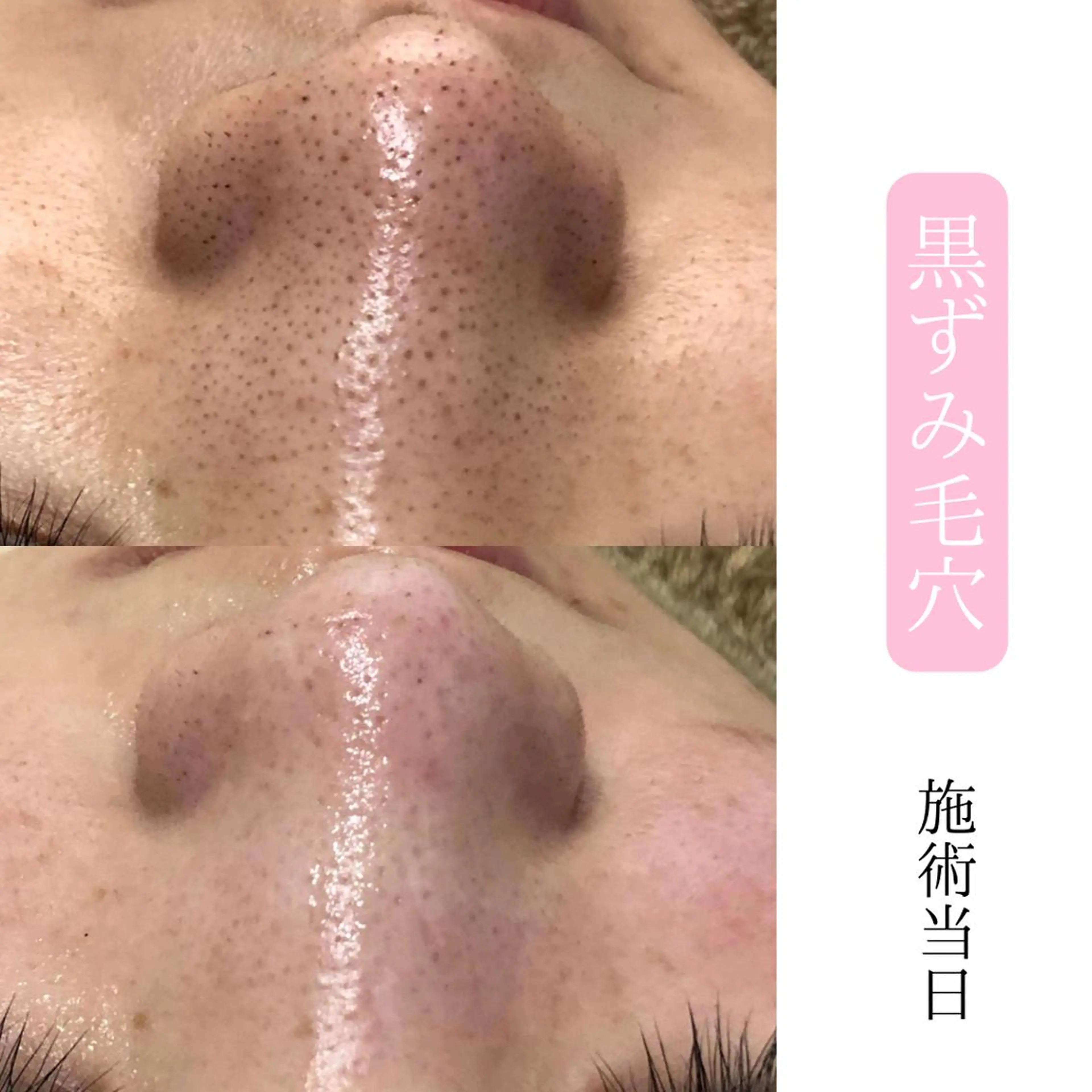 エステ 肌質改善サロン BestBelleのエステ・リラクイメージ