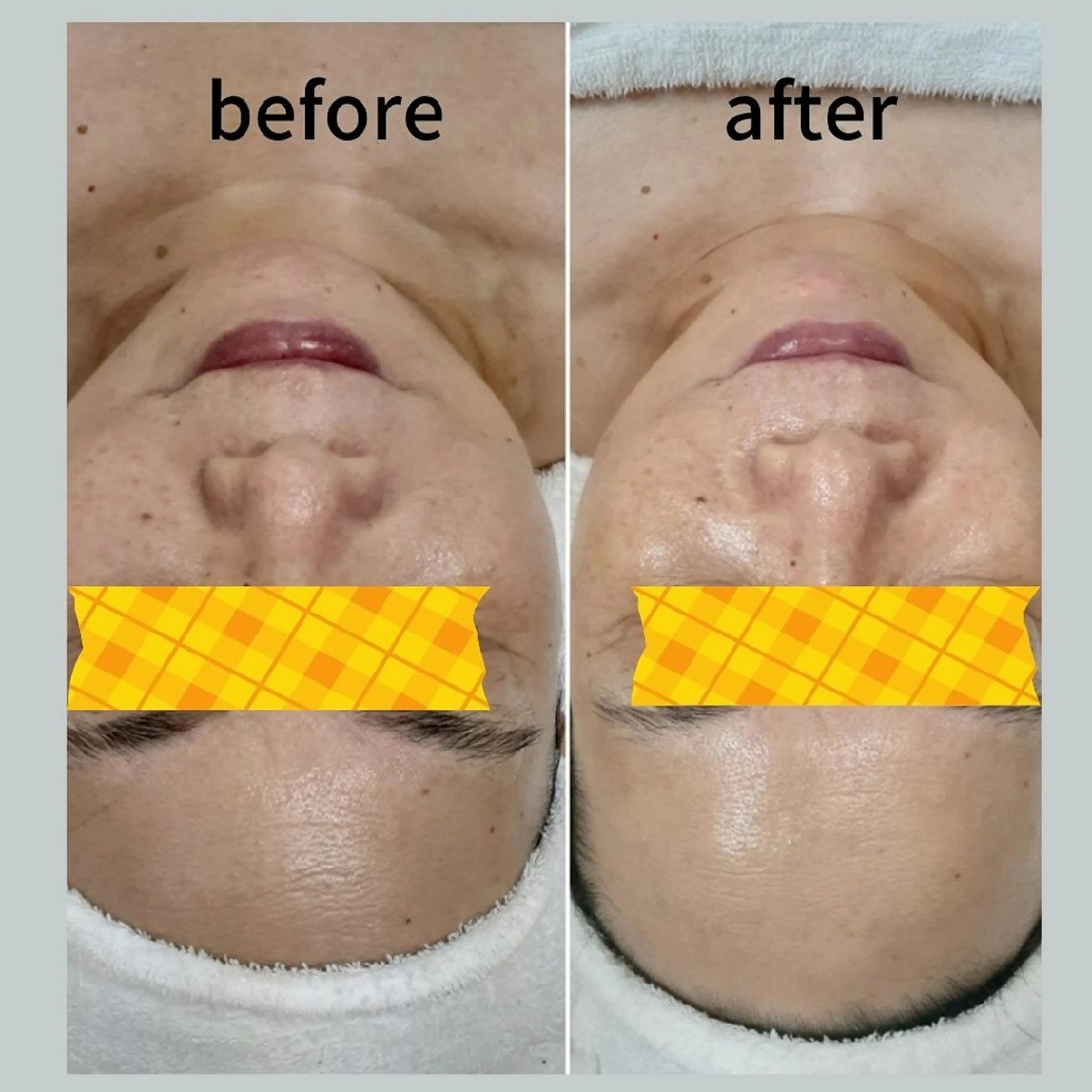 メナードフェイシャルサロンライズミュー所属・鈴木 由美のエステ・リラクイメージ