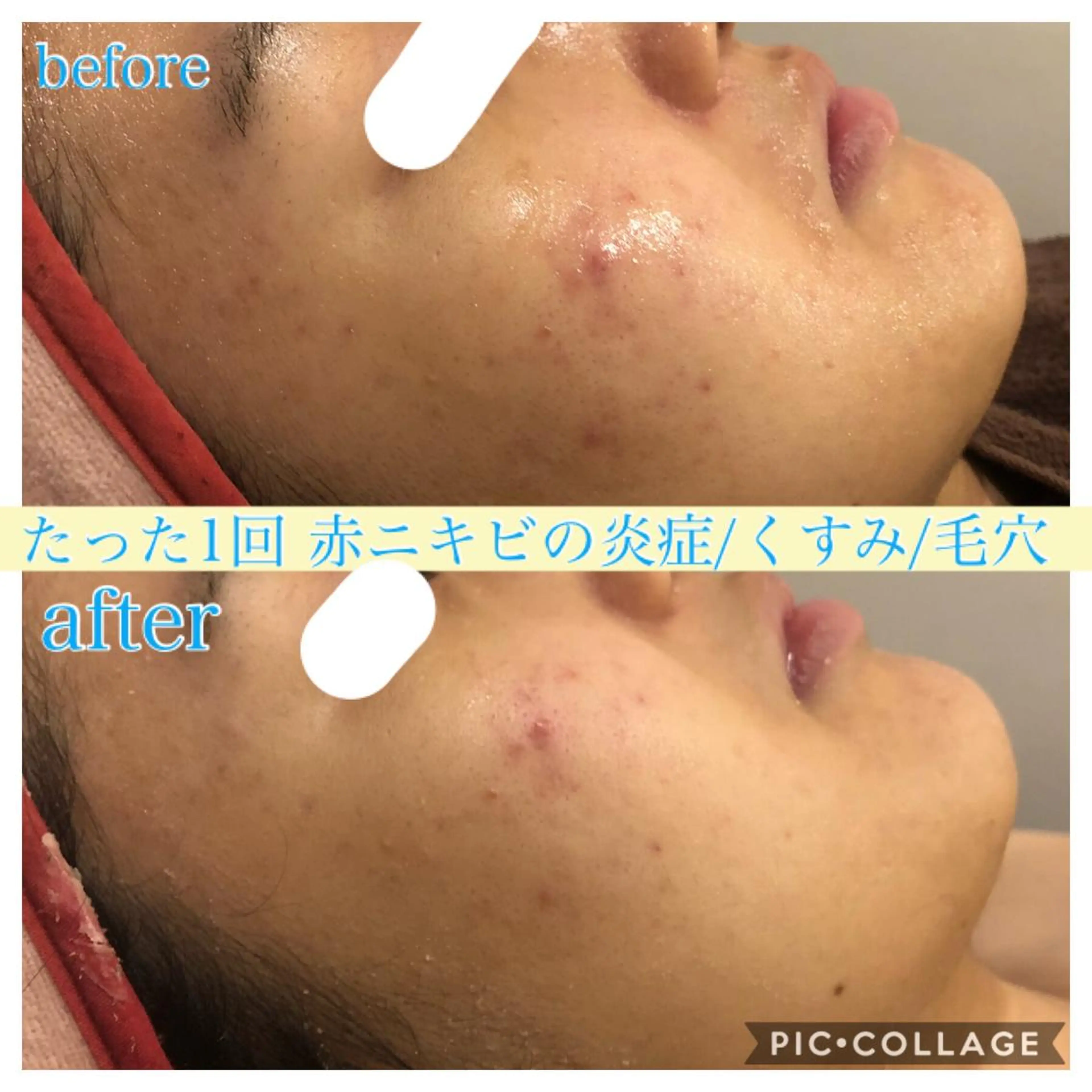 ロング カラー パーマ ヘアアレンジ キッズ ネイル マツエク・マツパ エステ リラク Ensor Clair所属・EnsorClair 代表　野口真央のエステ・リラクイメージ