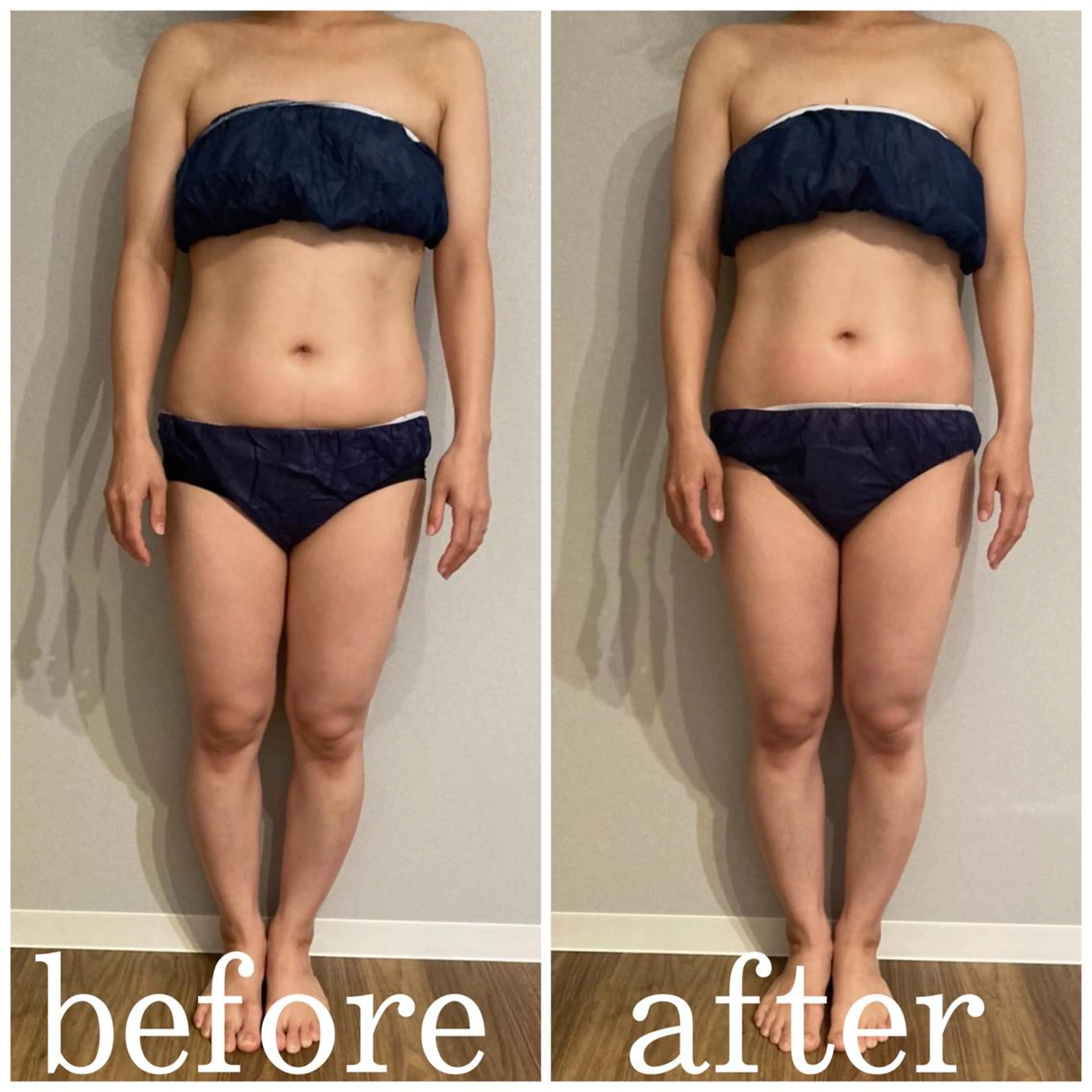 marron所属・痩身ハイパーナイフ ララピールリアボーテのエステ・リラクイメージ