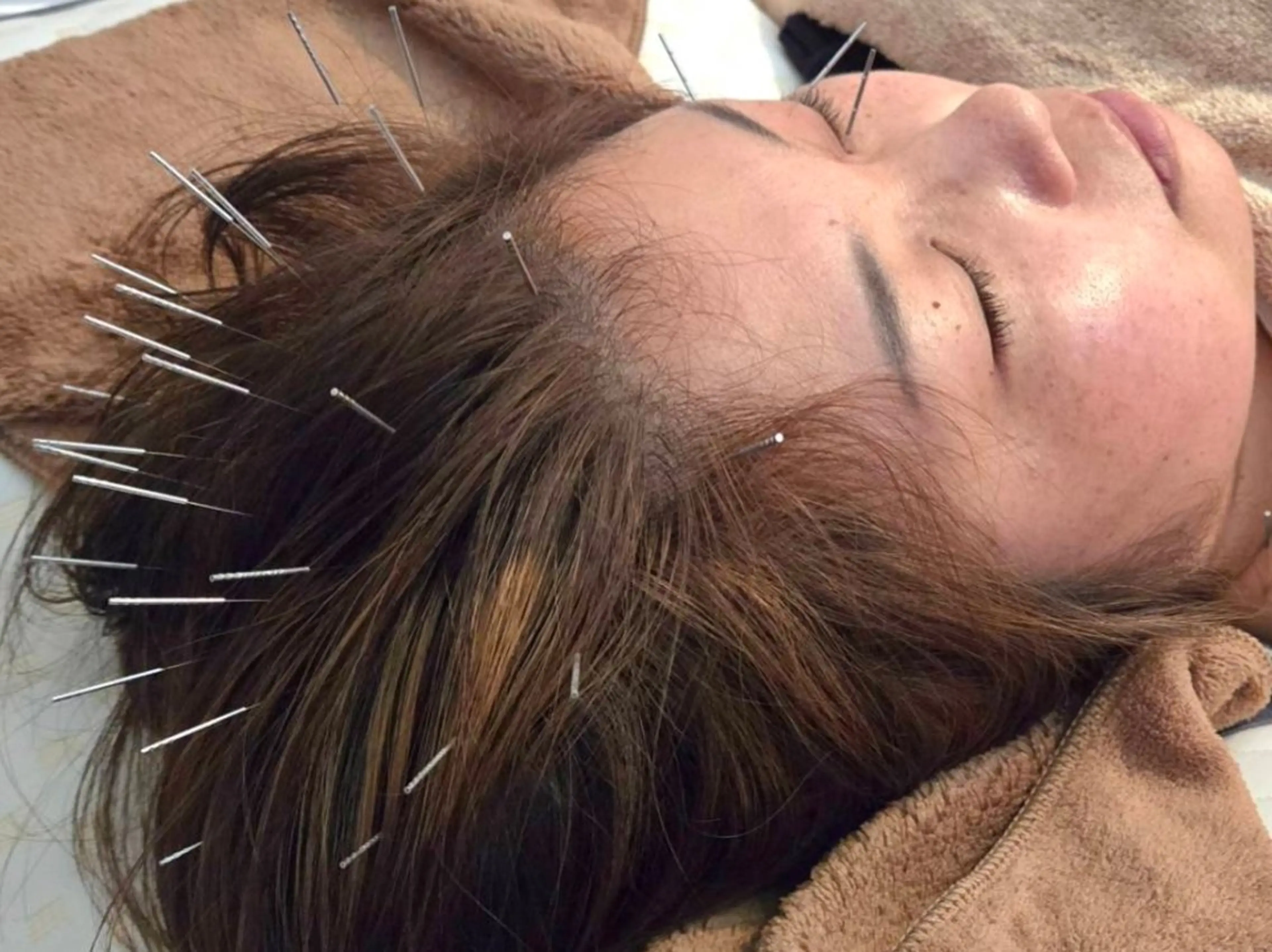 エステ リラク KANWA鍼灸院所属・KANWA 鍼灸院のエステ・リラクイメージ