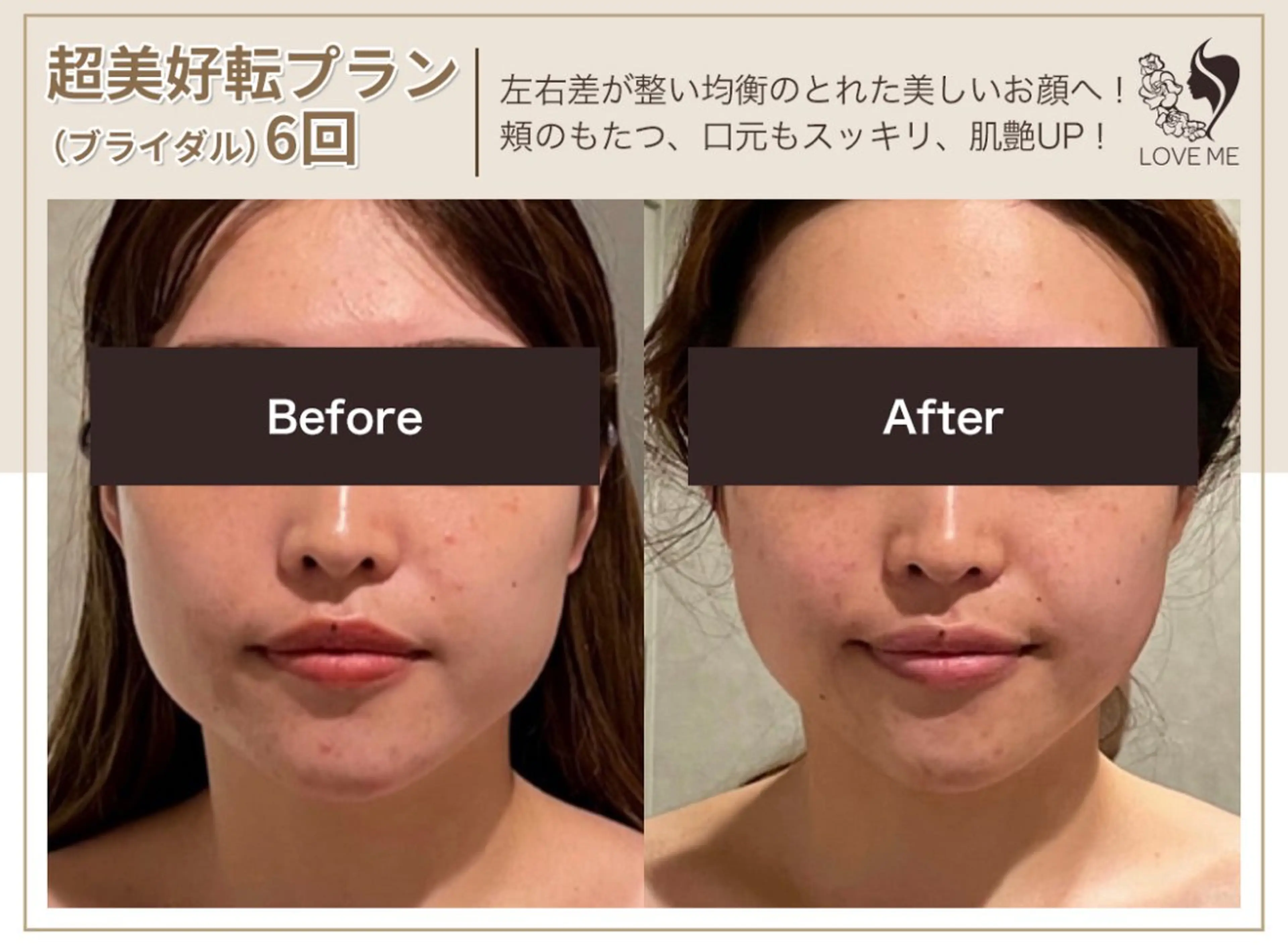 総合美容サロン LOVEME渋谷本店のエステ・リラクイメージ