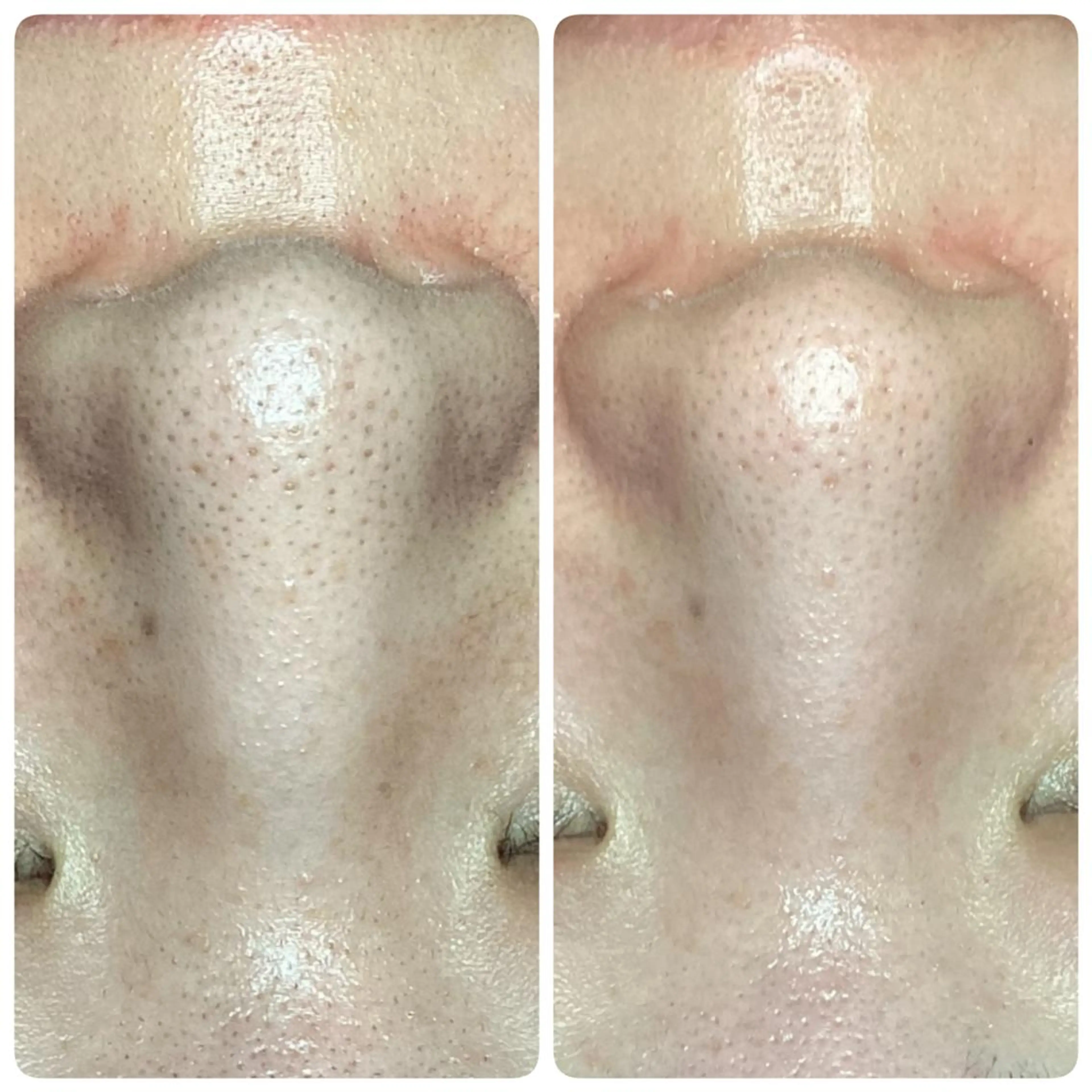 Biestora 郡山店/橋本のエステ・リラクイメージ