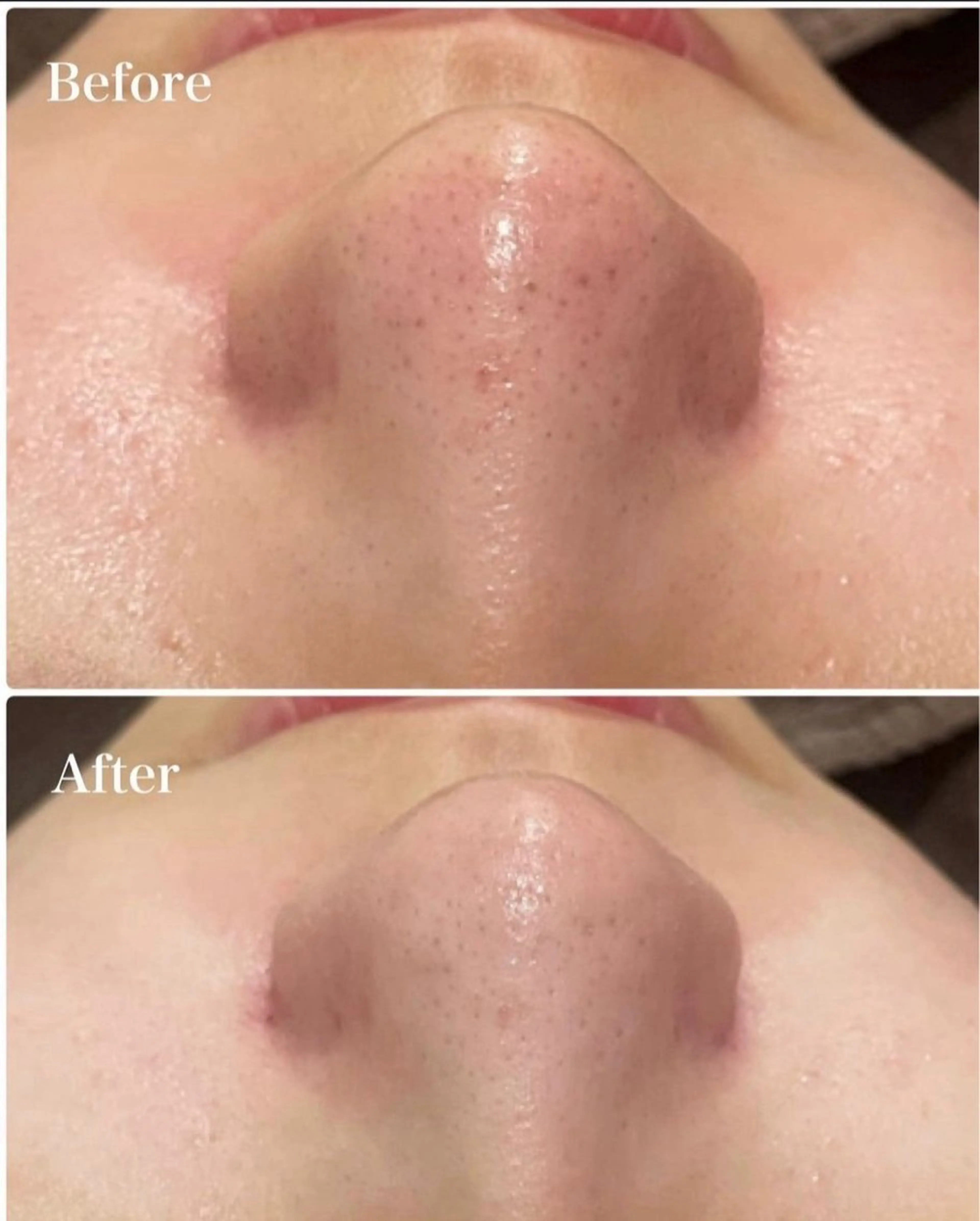 トータルビューティーサロンFirstclass所属・Firstclass Erikaのエステ・リラクイメージ