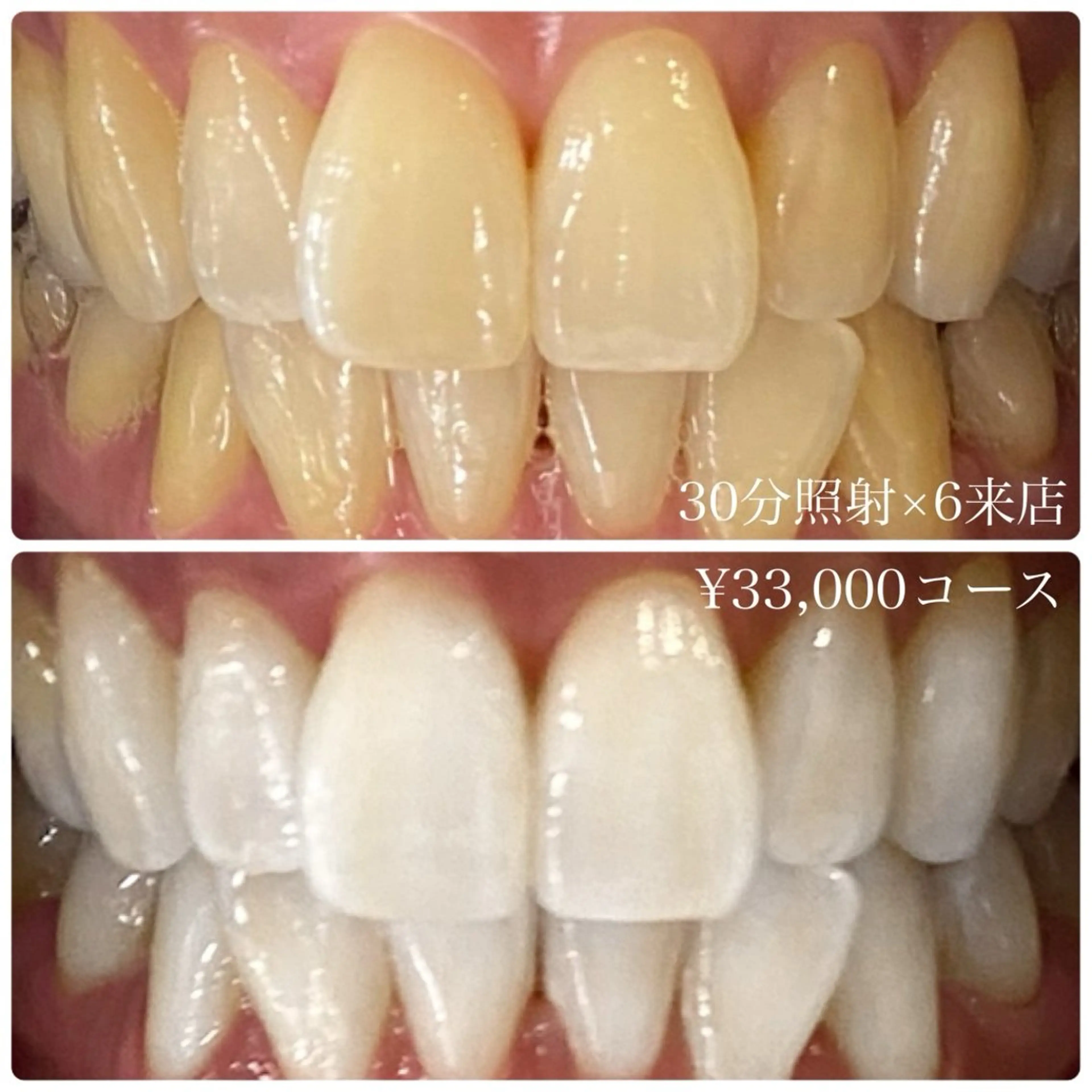 PLATINUM Beauty 横浜店所属・ホワイトニングルーム 横浜店のその他イメージ