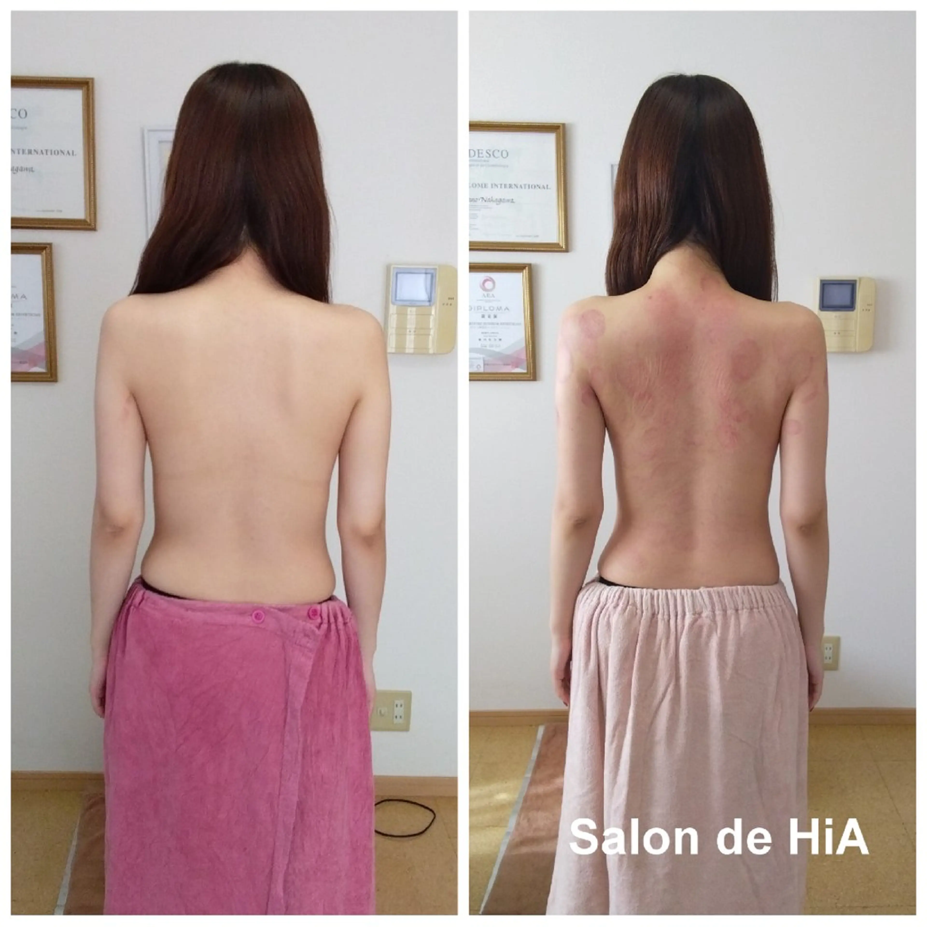 エステ リラク Salon de  HiAのエステ・リラクイメージ